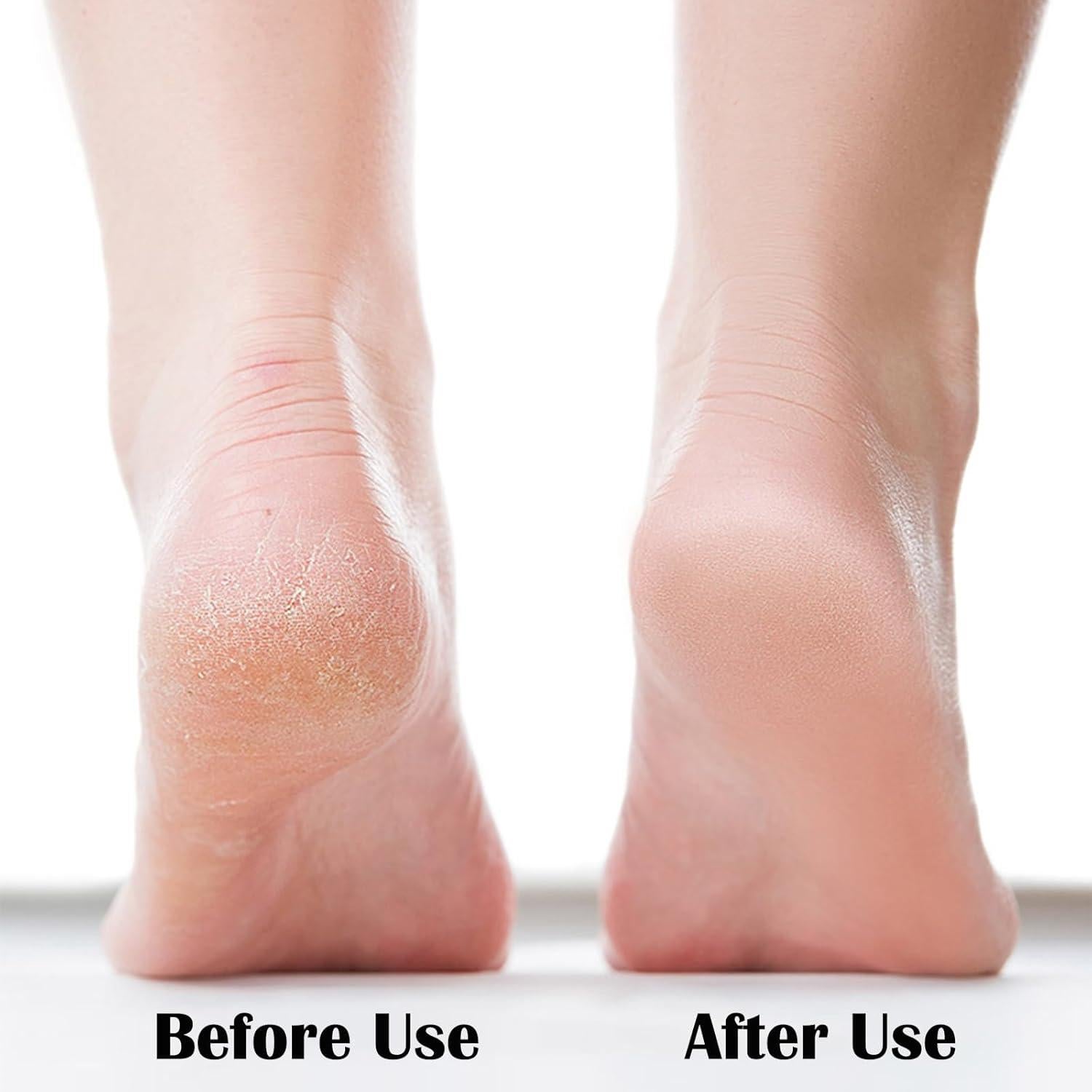 Lima de Pies de Vidrio Nano Shenzhen - Removedor de Callos