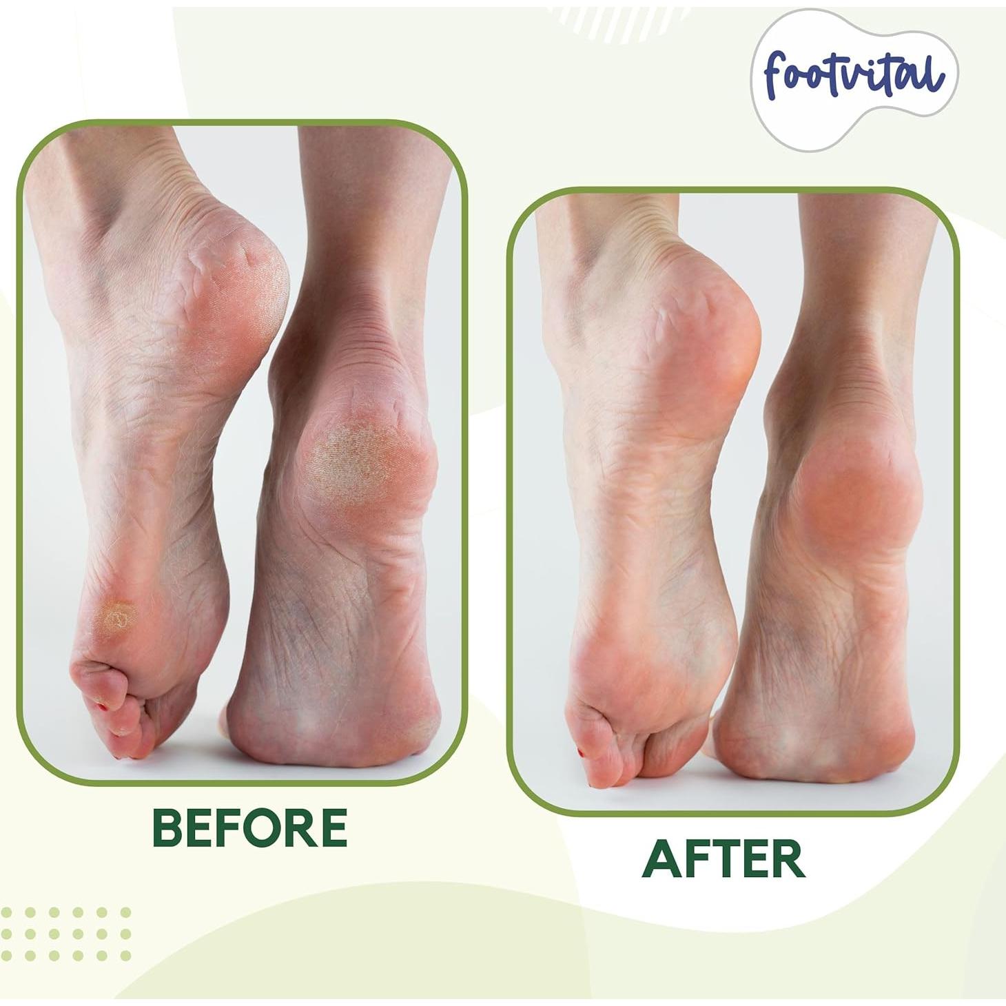 Piedra Pómez Exfoliadora Footvital 12.7 cm Natural