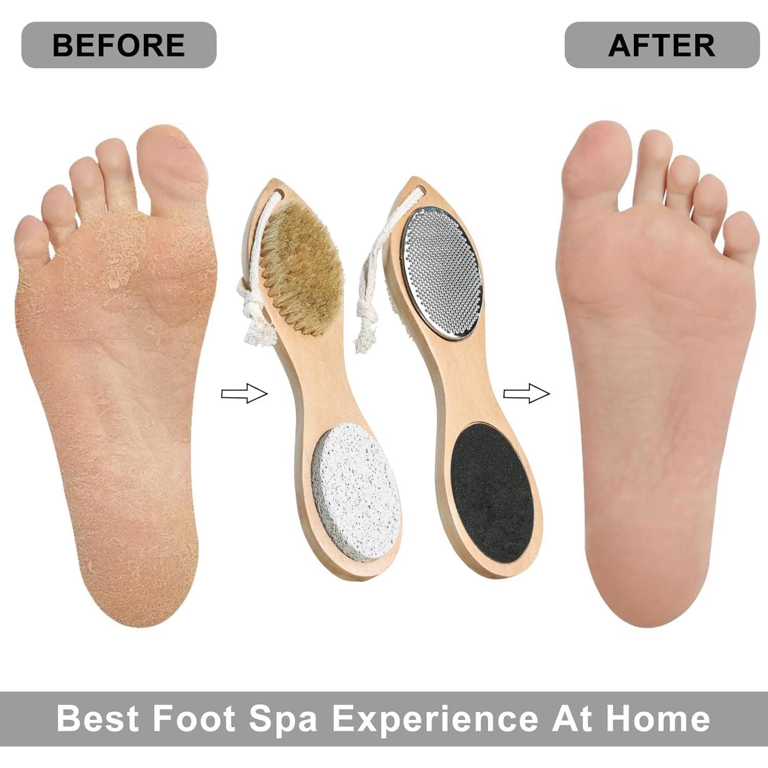 Piedra Pómez 4 en 1 Beomeen para Cuidado de Pies