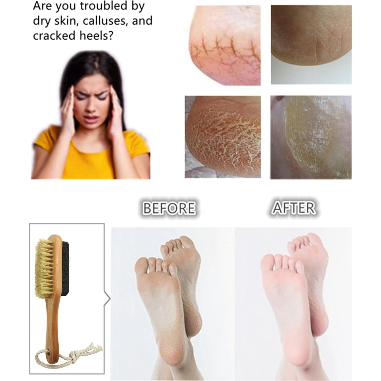 Piedra Pómez Natural YIOYOODA con Cepillo para Pies - Exfoliador Doble Cara