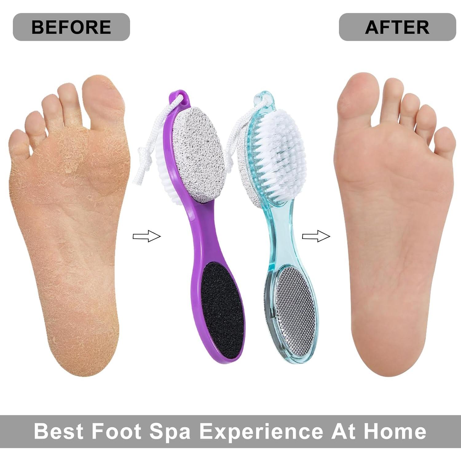 Lima para Pies 4 en 1 Beomeen - Exfoliante y Cepillo Ergonómico