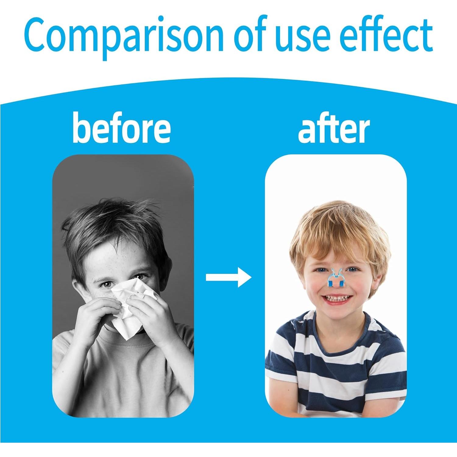 60 Clips Nasales de Espuma MOSIOBERDAVIAN para Hemorragias