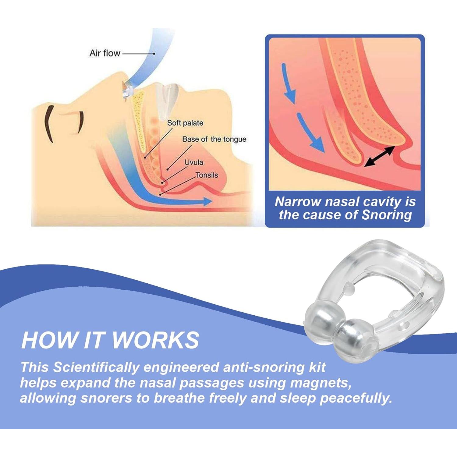 Paquete de 6 Clips Nasales Magnéticos Mobi Lock - Silicona Reutilizable
