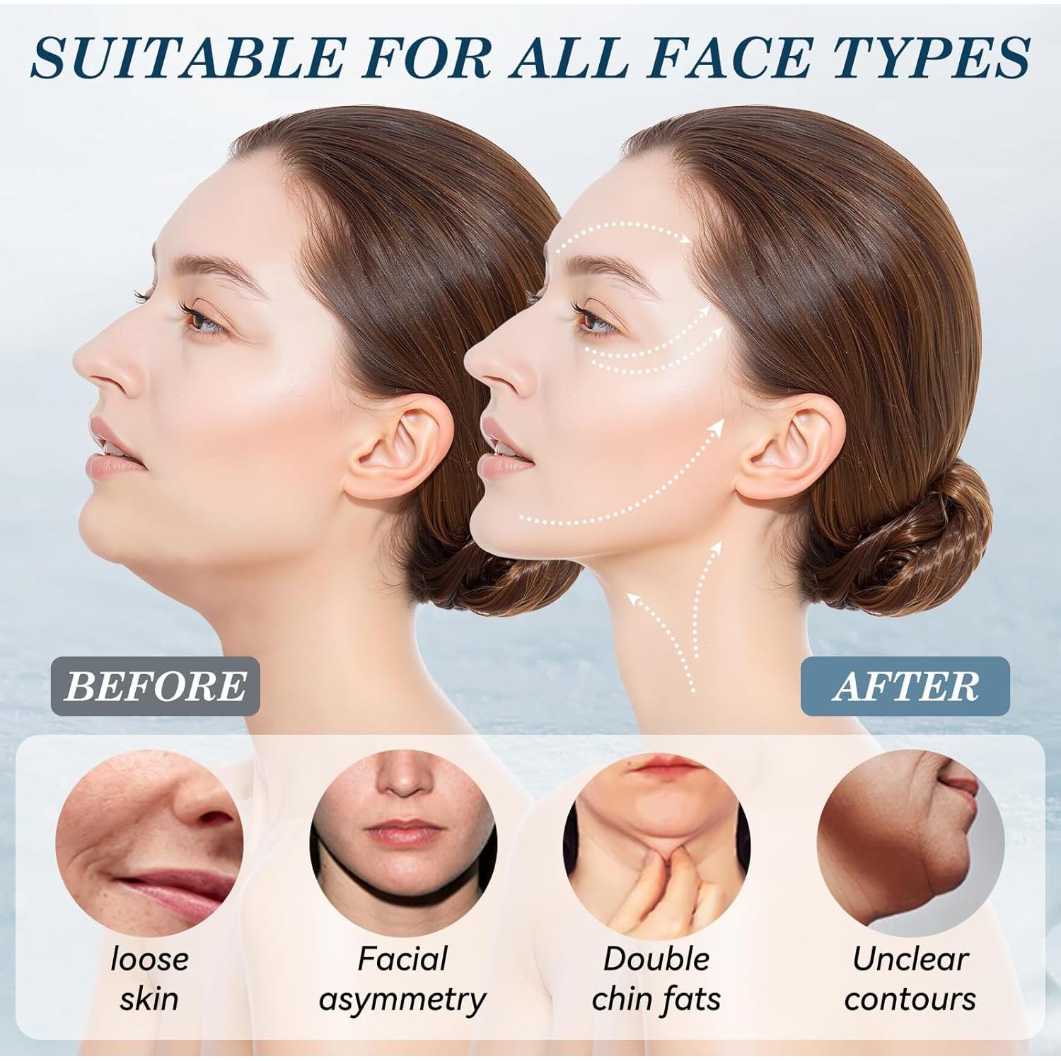 Correa de Barbilla Ajustable JUSRON para Dormir - Modelador Facial