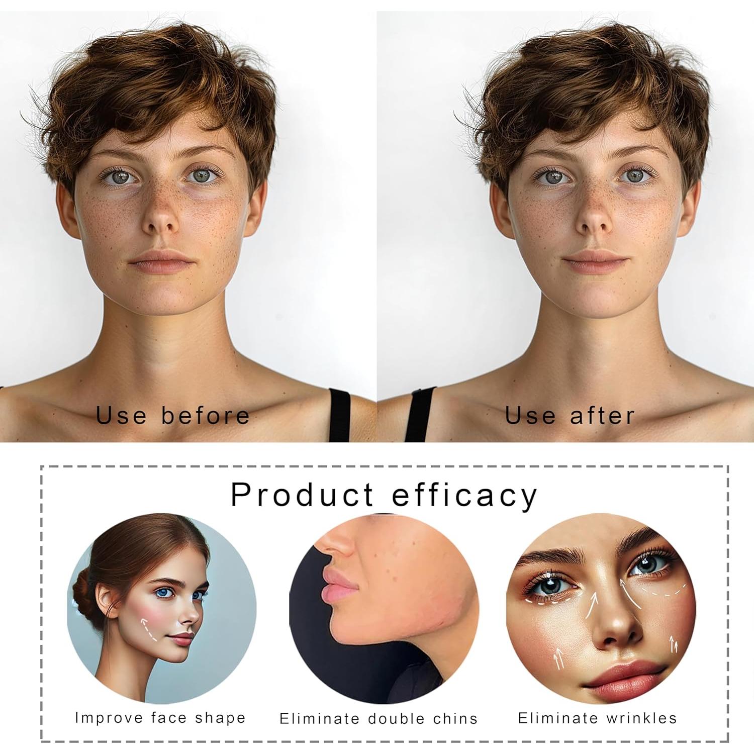 Correa Facial Reutilizable Yuibthr para Dormir - Elevación Barbilla