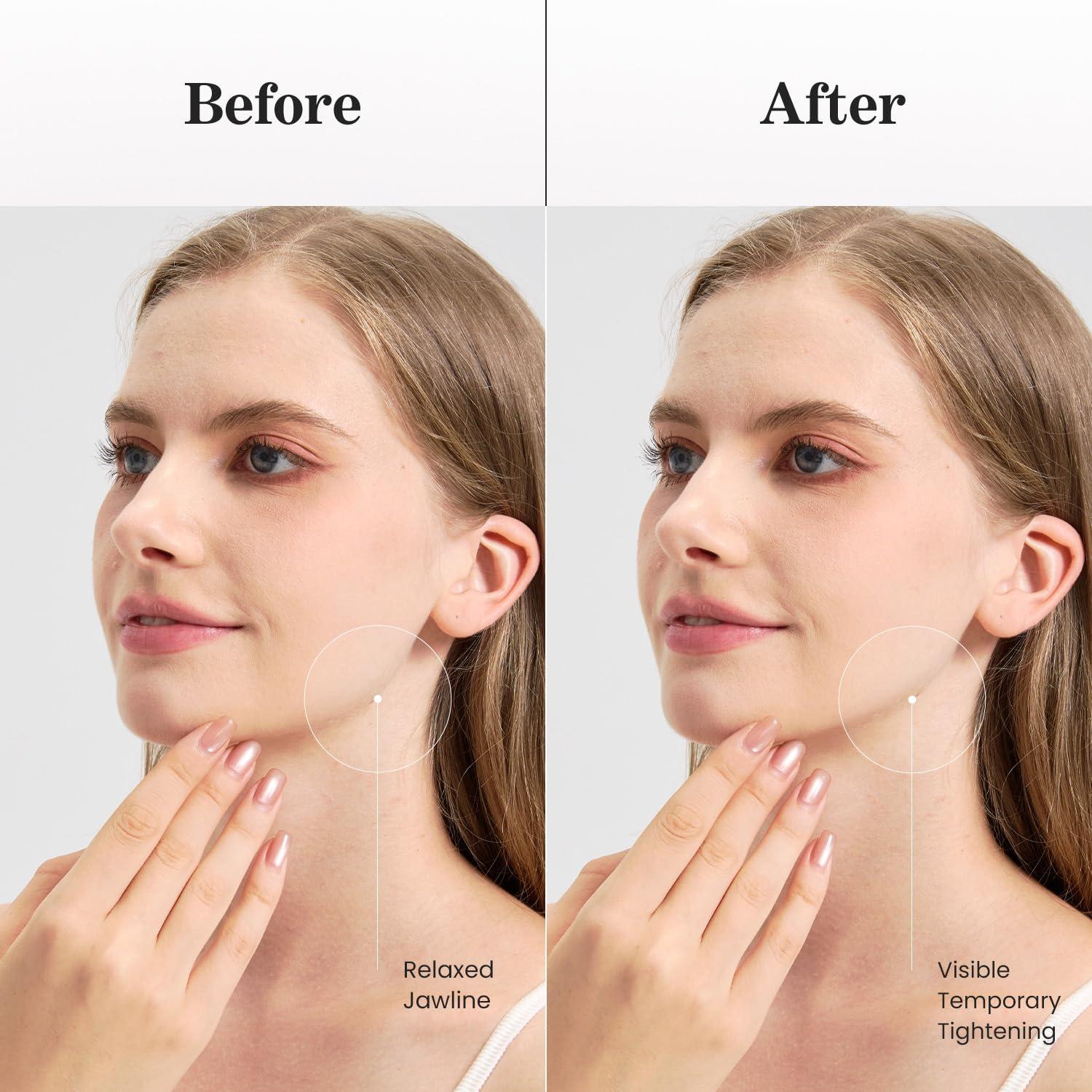 Mascarilla V Line Lifting Mroobest con Oro Rosa - 7 Unidades