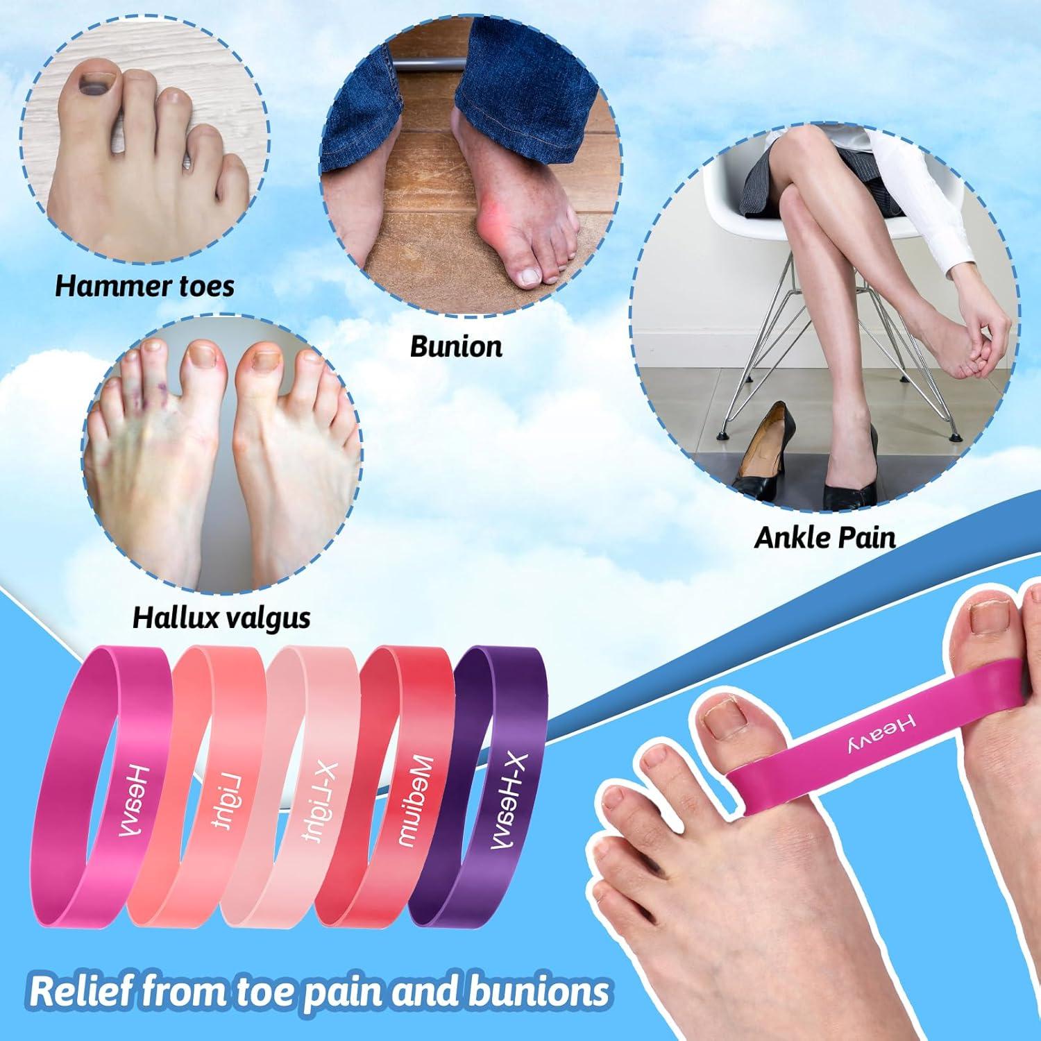 Bandas de Separación para Dedos HekouJiub - 5 Piezas Rosa