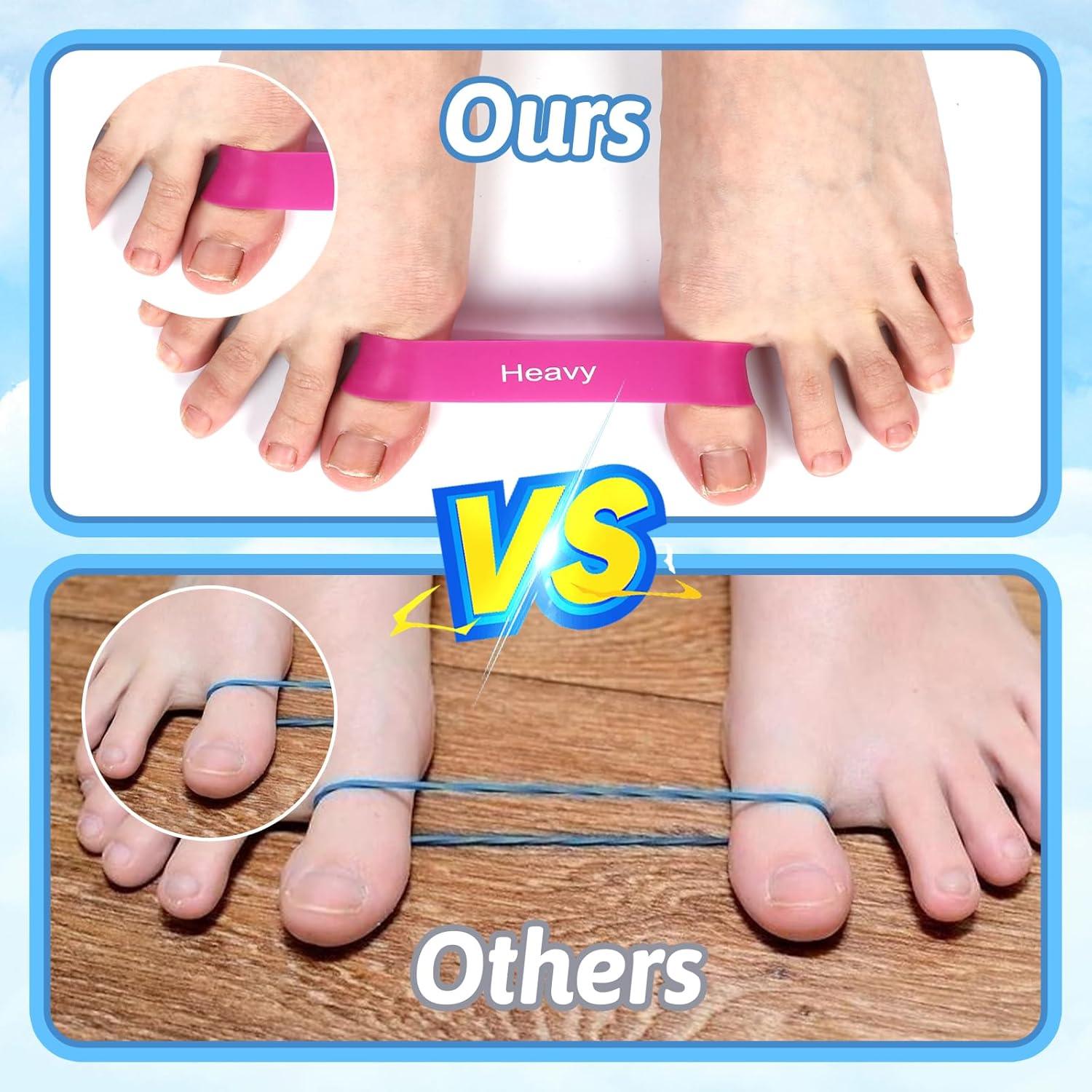 Bandas de Separación para Dedos HekouJiub - 5 Piezas Rosa