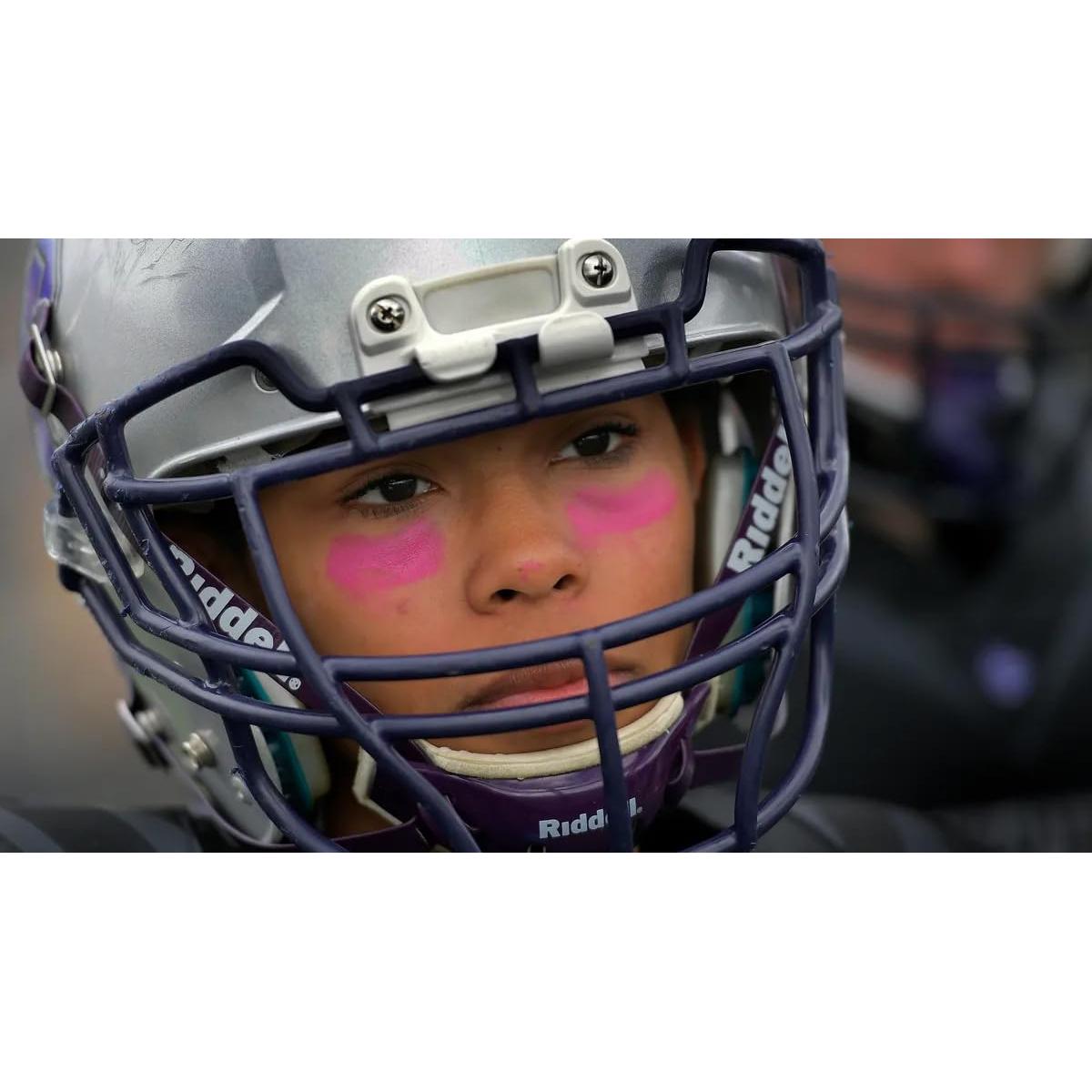 Barra Negra para Ojos DALVGFN Rosa Brillante 6.86cm Anti-reflejo