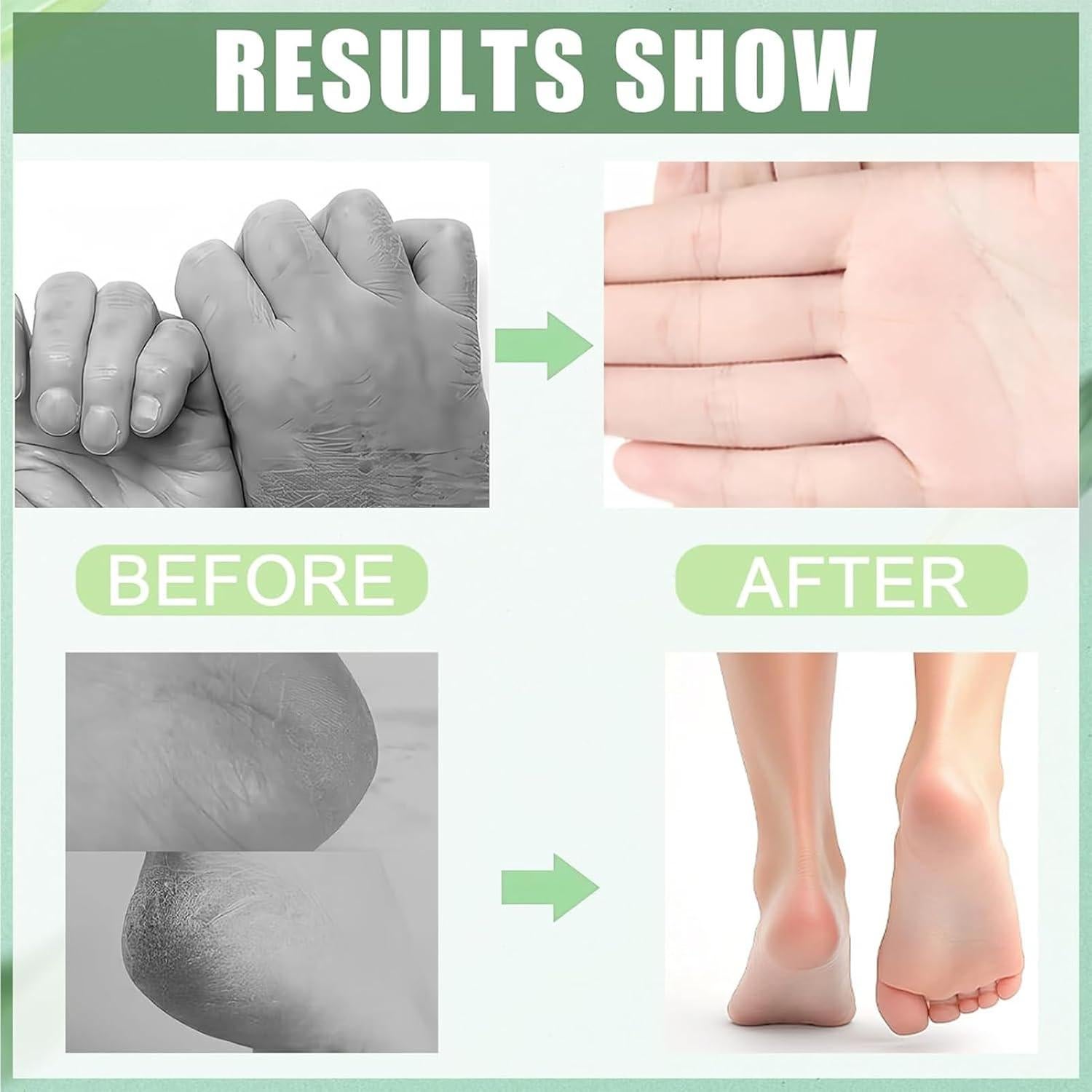 Set de Crema Hidratante para Pies y Manos 60% Urea 2 Piezas