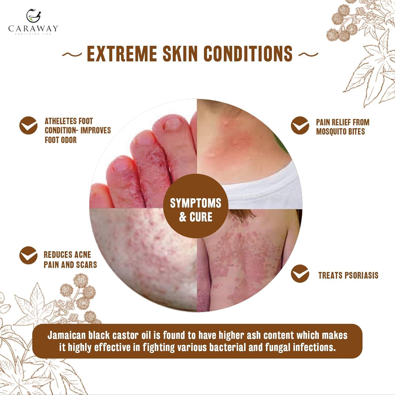 Aceite de Ricino Negro Jamaicano Caraway 118ml + Kit de Máscara