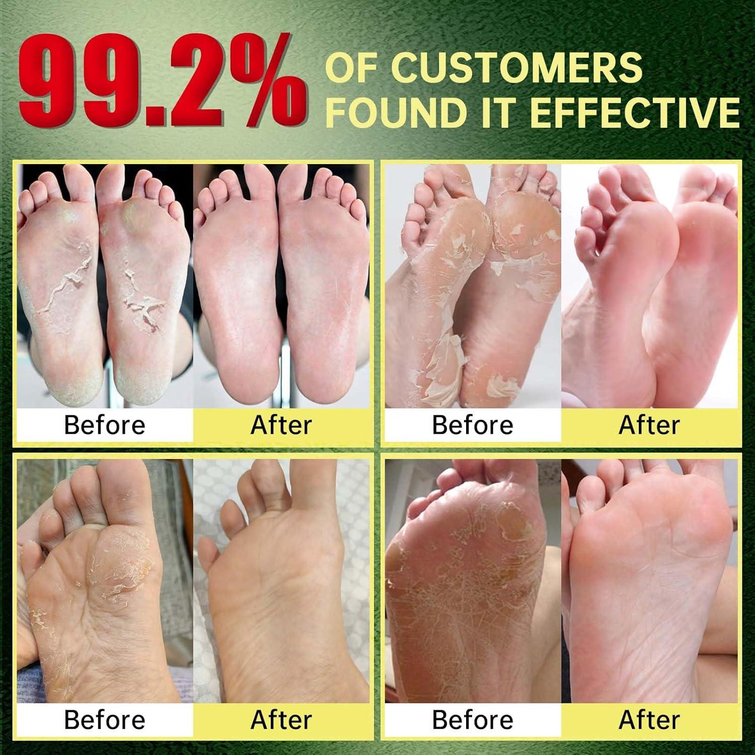 Mascarilla Exfoliante para Pies FLYLEAF - Hidratante y Suave (3 Pzas)