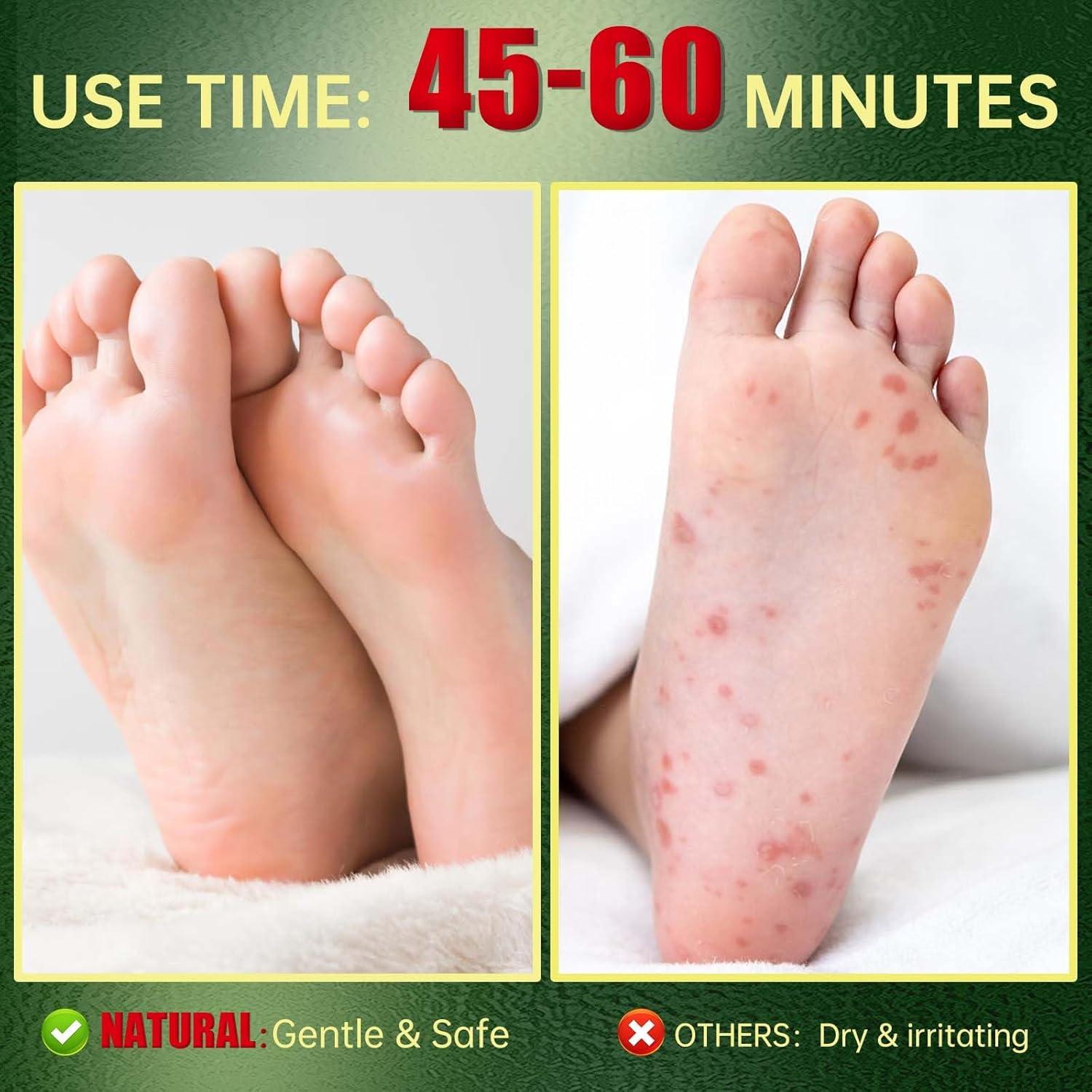 Mascarilla Exfoliante para Pies FLYLEAF - Hidratante y Suave (3 Pzas)