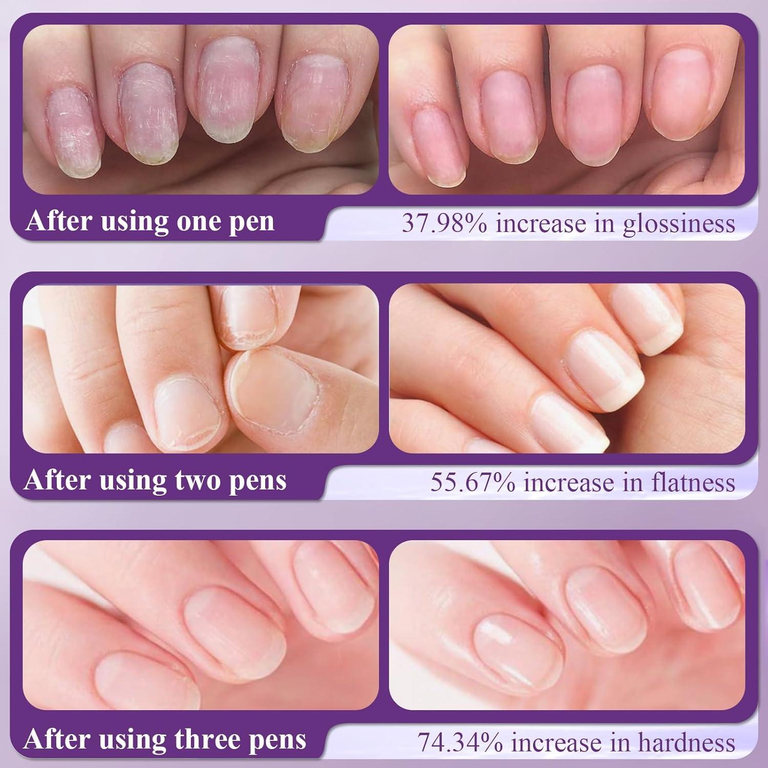 Bolígrafo de Aceite para Cutículas 3 en 1 Plman - Cuidado de Uñas