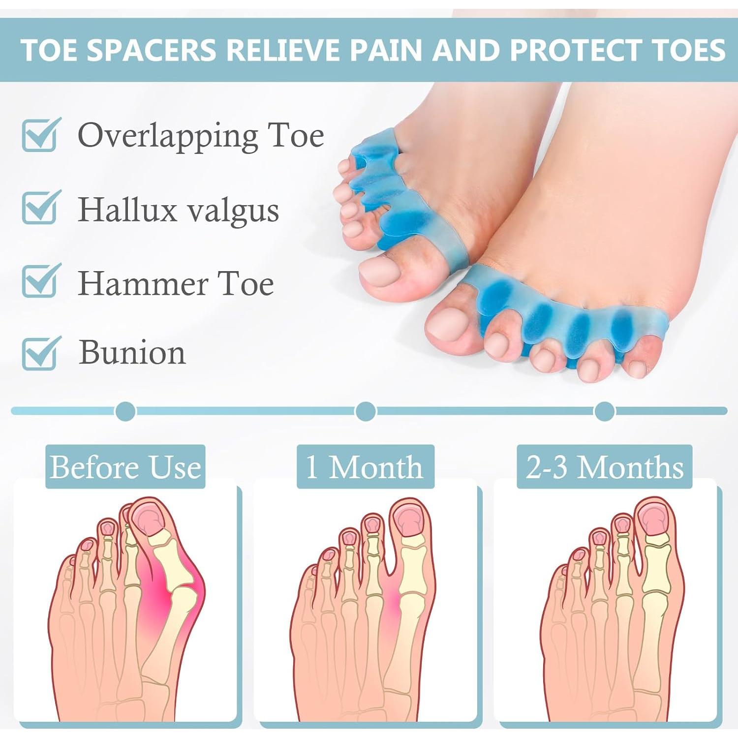 Separadores de Dedos de Silicona Sundpik - 2 Piezas Azul