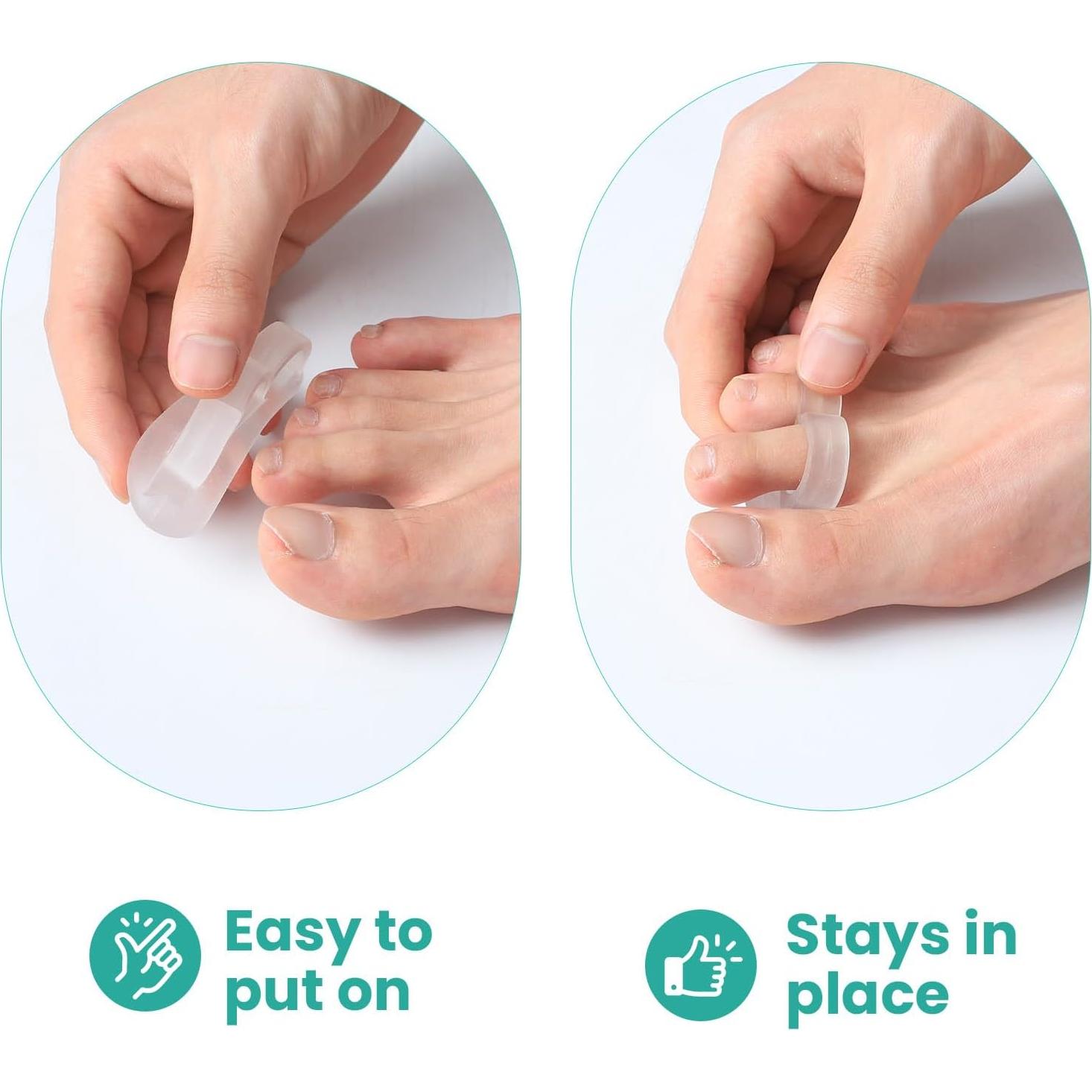 Corrector de Dedos en Martillo Welnove - 8 Piezas Gel Silicona