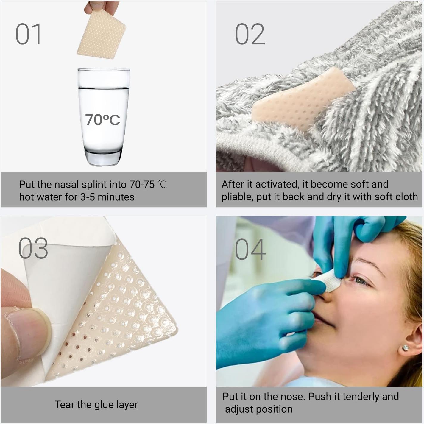 Férulas Nasales Termoplásticas QIYAT - 5 PCS Mediano