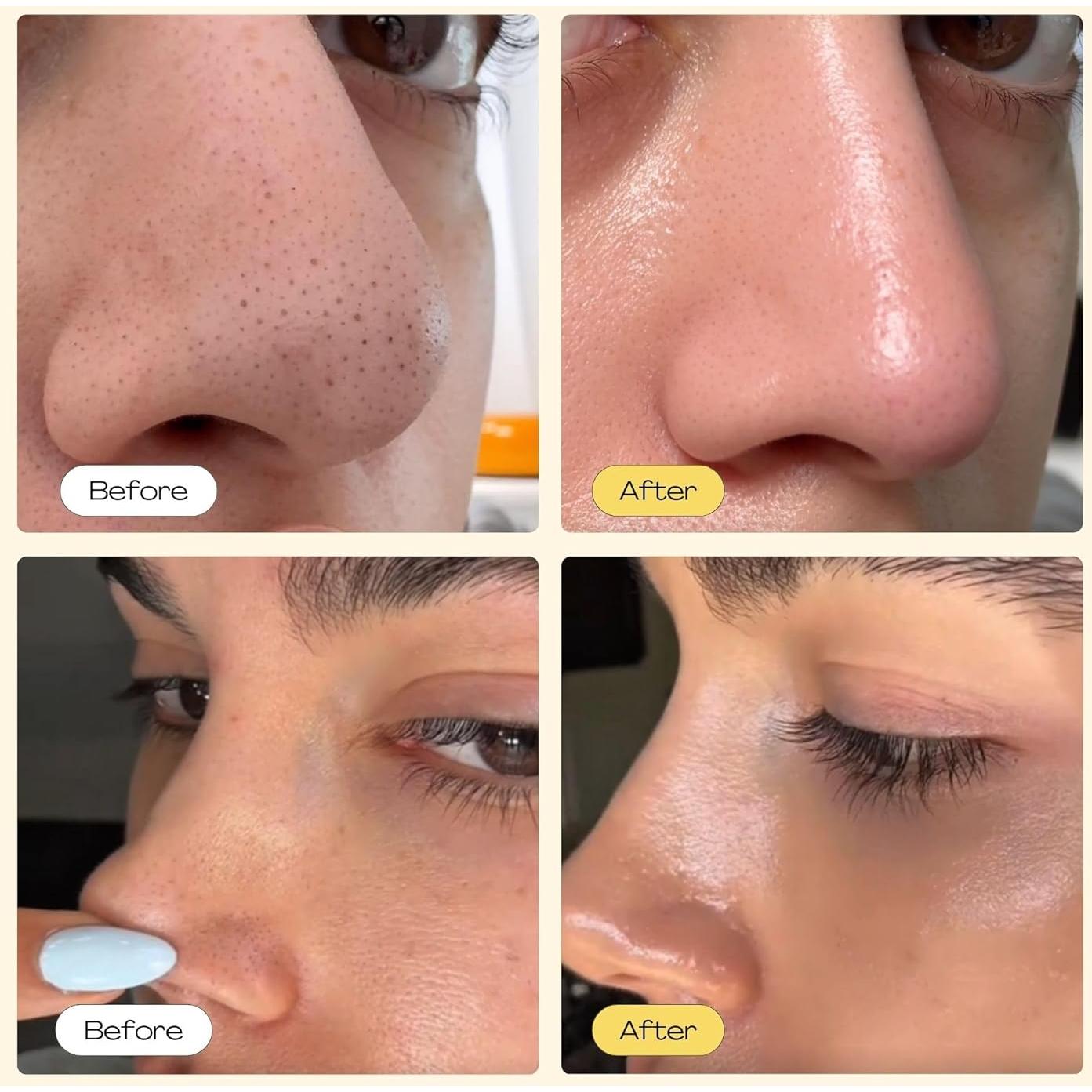 Tiras para Poros Luelle 100 PCS - Limpieza Profunda y Peel Off