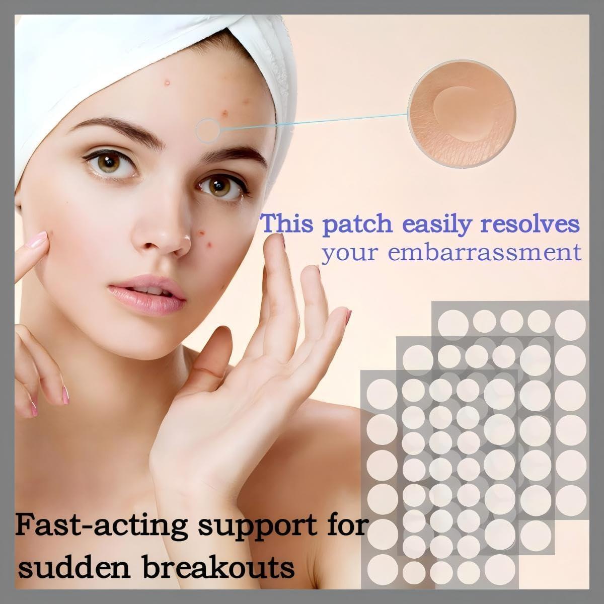 Parche Hidrocoloide para Granitos Guiyal - 112 Piezas, 3 Tamaños