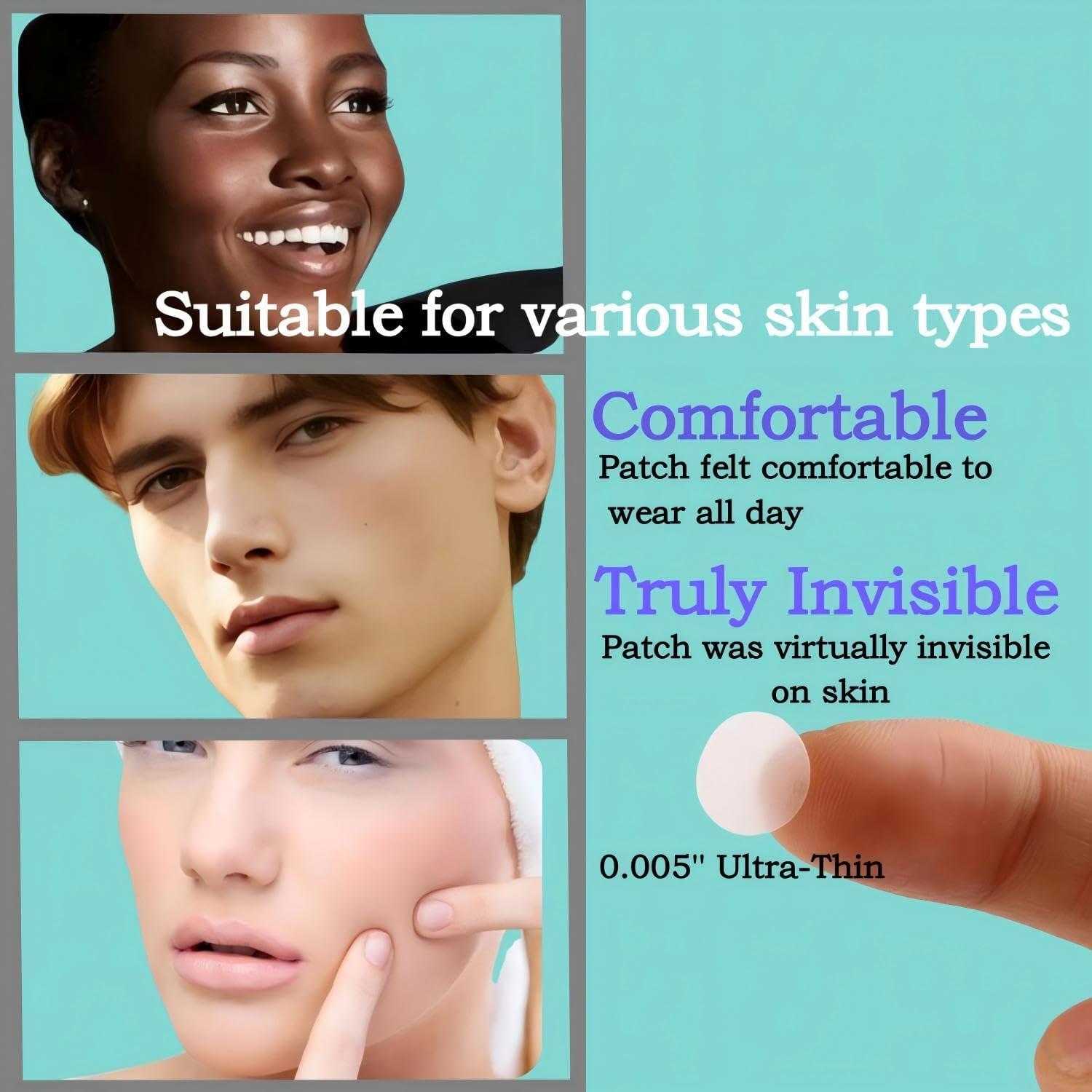 Parche Hidrocoloide para Granitos Guiyal - 112 Piezas, 3 Tamaños