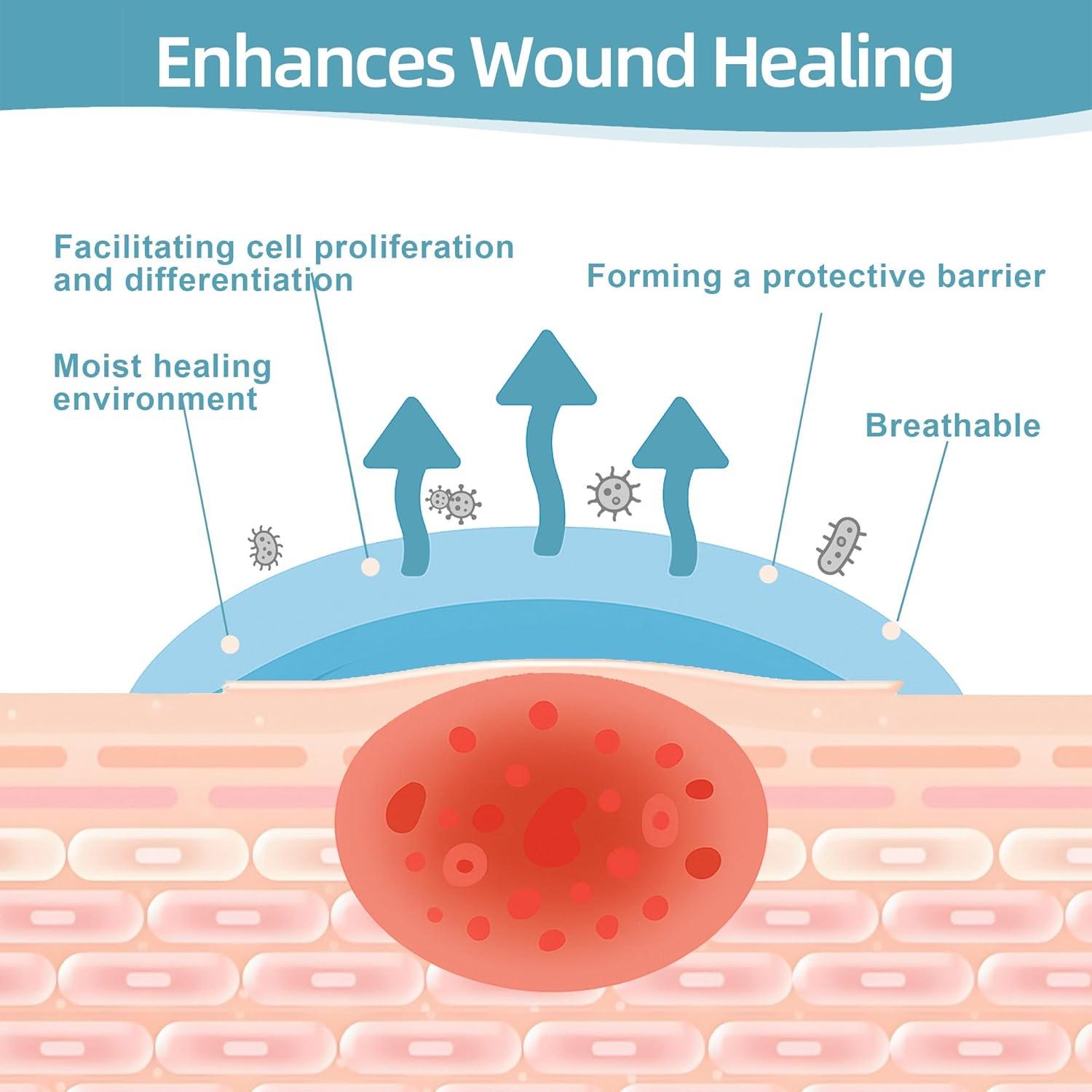 Vendaje de Hidrocoloide Dkmord 5.08cm x 2.01m para Heridas