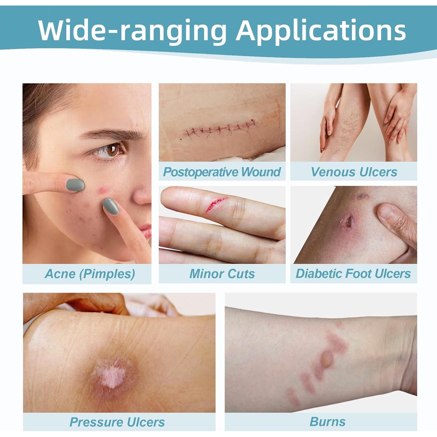 Vendaje de Hidrocoloide Dkmord 5.08cm x 2.01m para Heridas