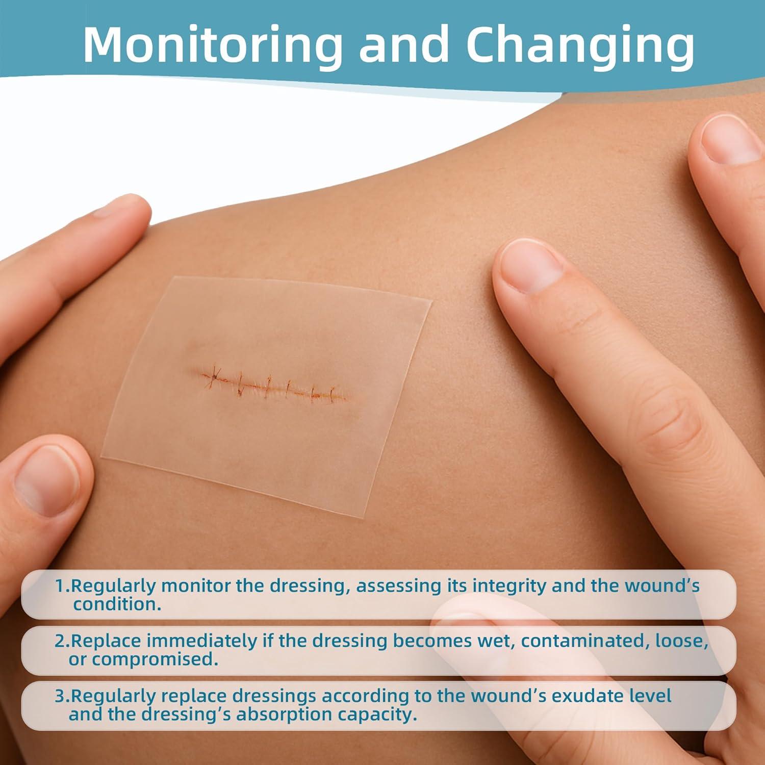 Vendaje de Hidrocoloide Dkmord 5.08cm x 2.01m para Heridas