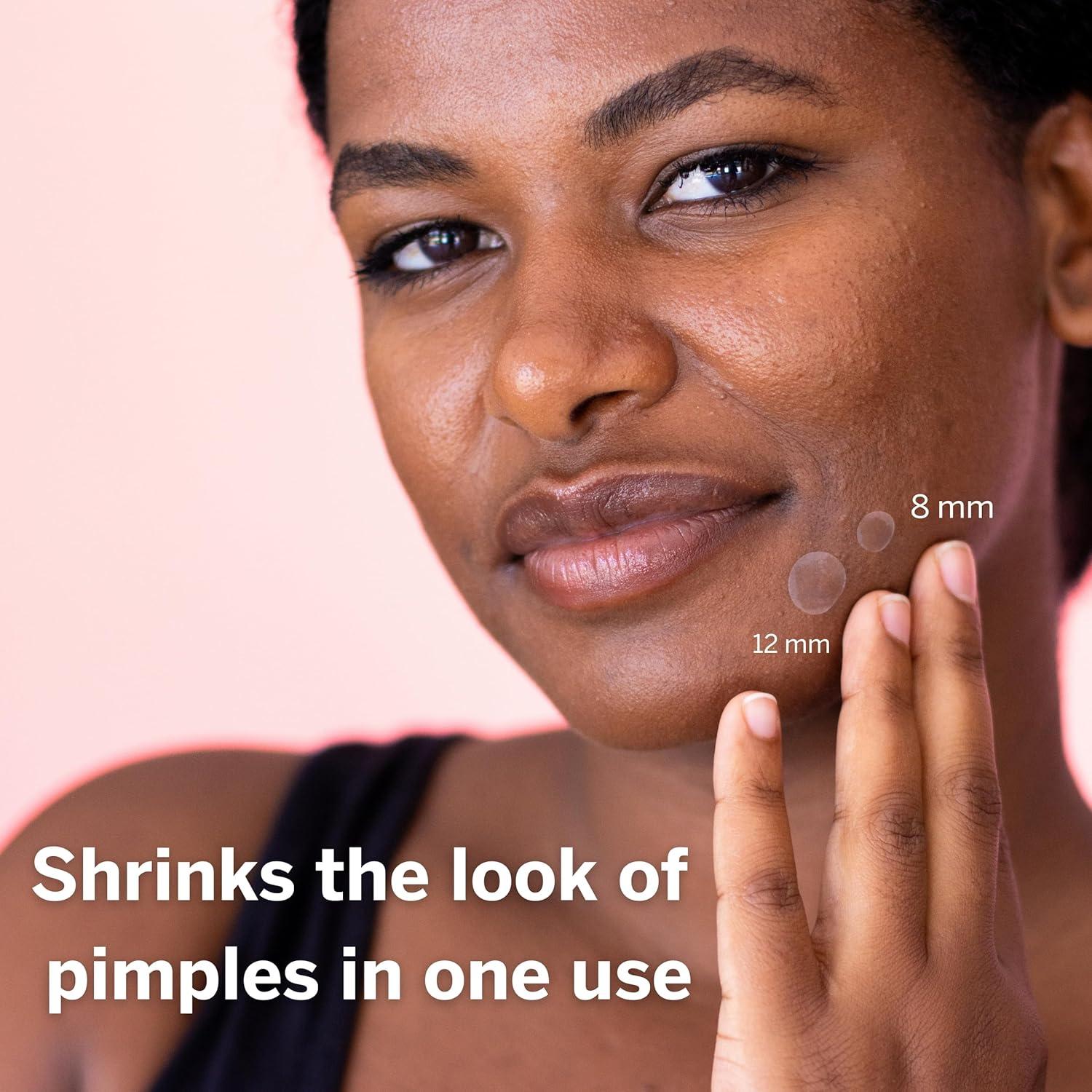 Parche Hidrocoloide para Granos Dot - 36 Unidades (8mm y 12mm)