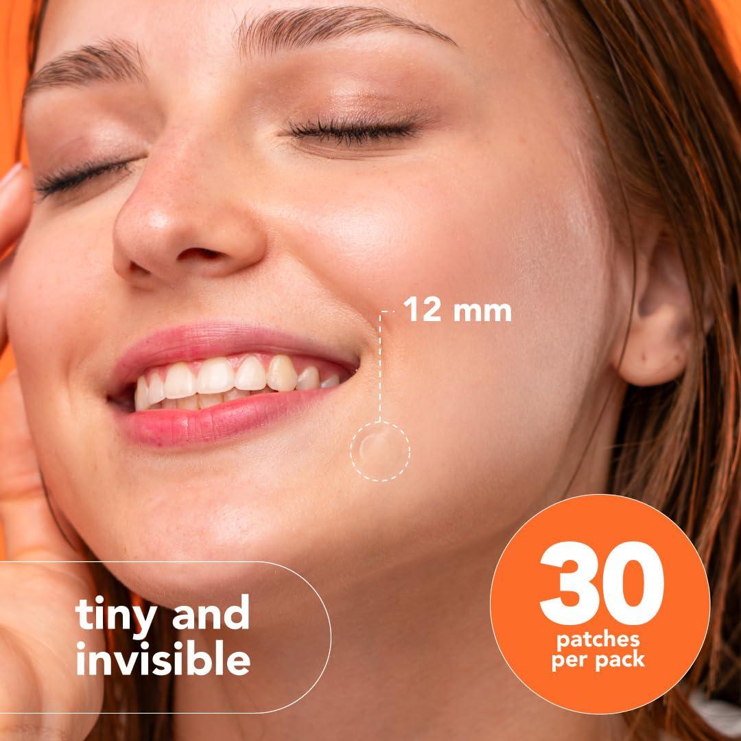 Parches Hidrocoloides Alux para Granitos - 30 Unidades