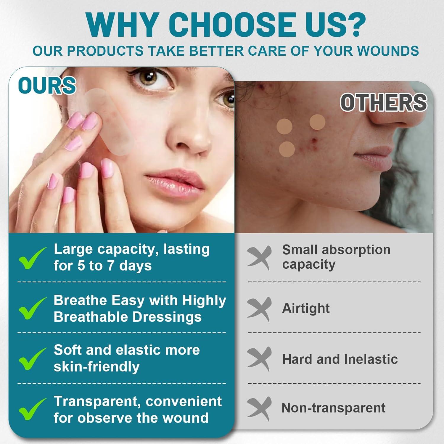 Parches Hidrocoloides para Granos WUYUAN 1.68cm x 190.5cm