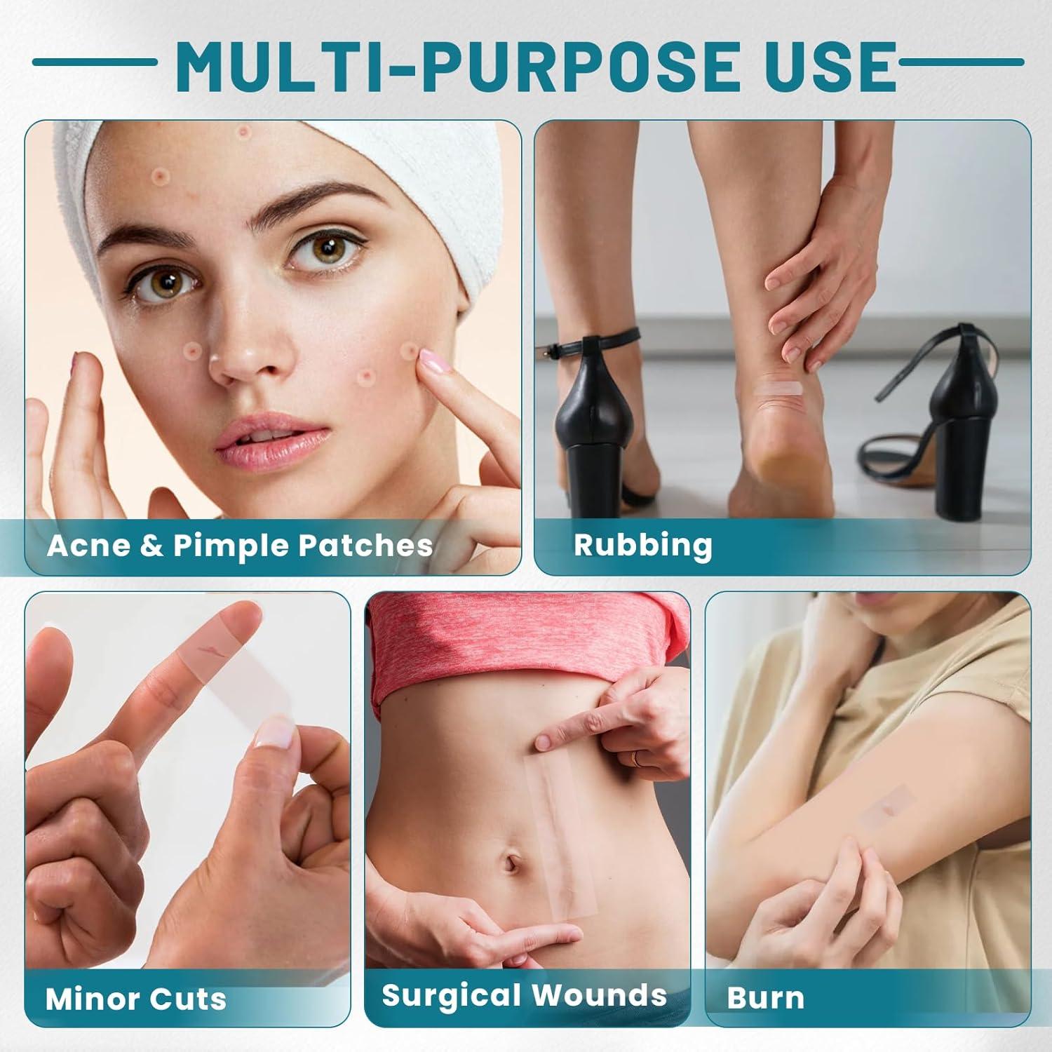 Parches Hidrocoloides para Granos WUYUAN 1.68cm x 190.5cm