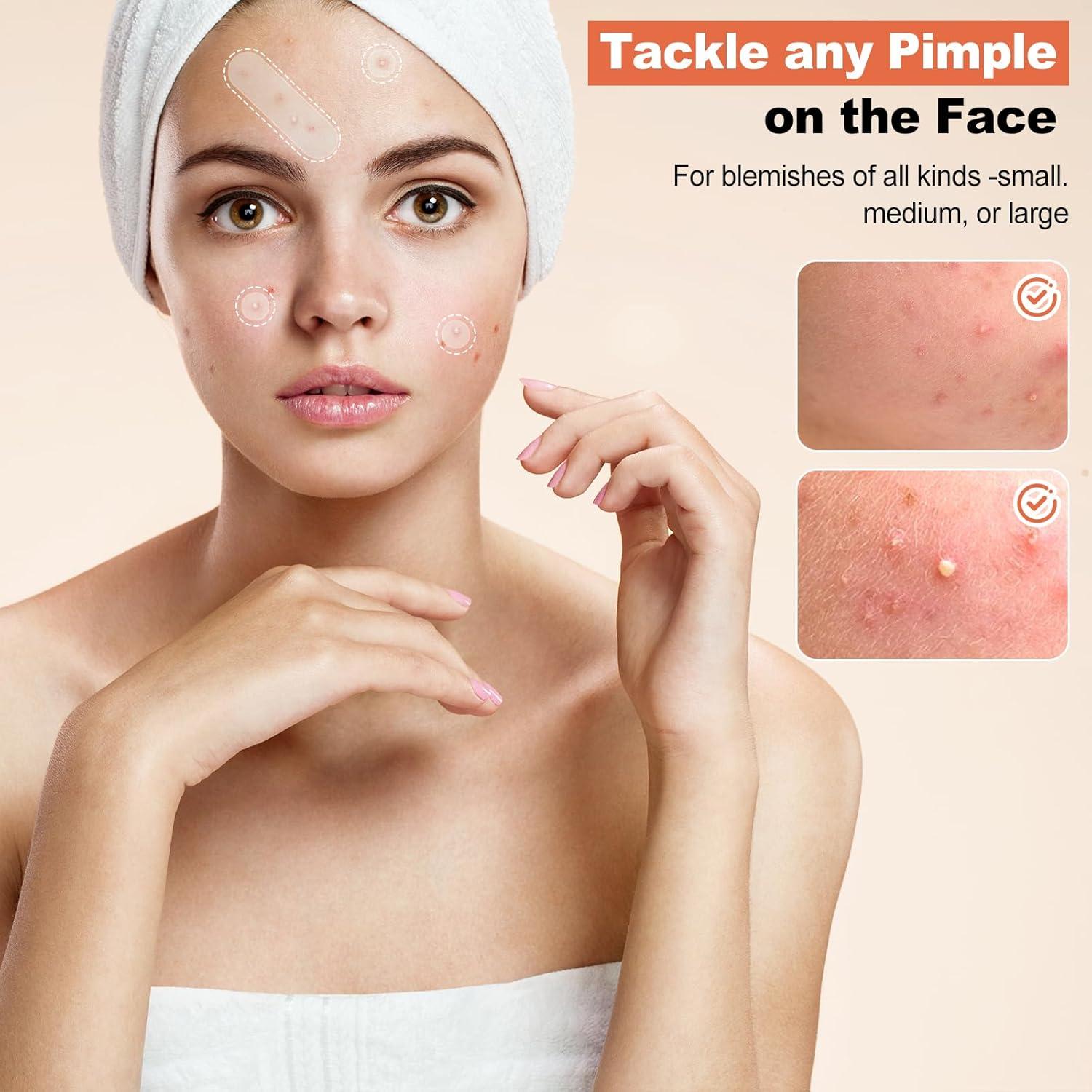 Parche Hidrocoloide para Acné Cabiuty - 68 Parches de 3 Tamaños