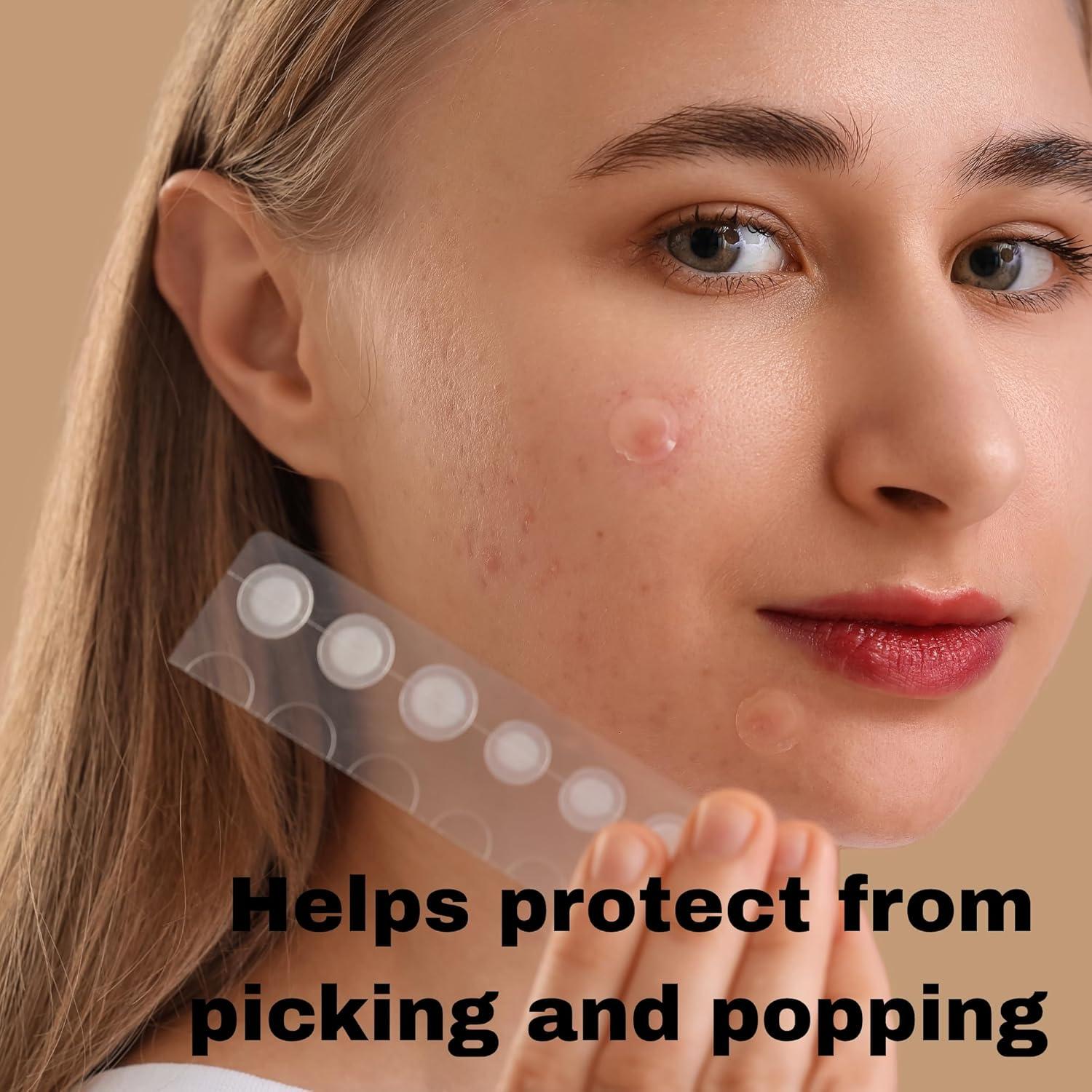 Parche de Acné Hidrocoloide BitMark - 42 Unidades con Espejo