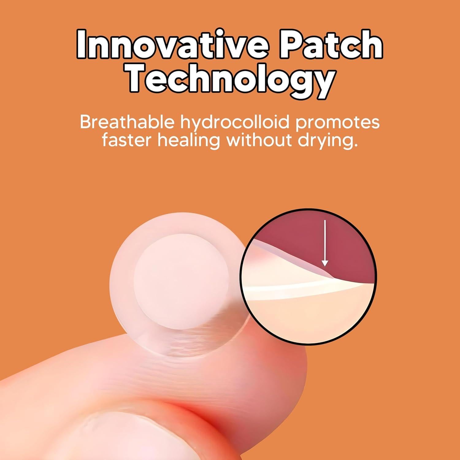 Parche de Acné Hidrocoloide BitMark - 42 Unidades con Espejo