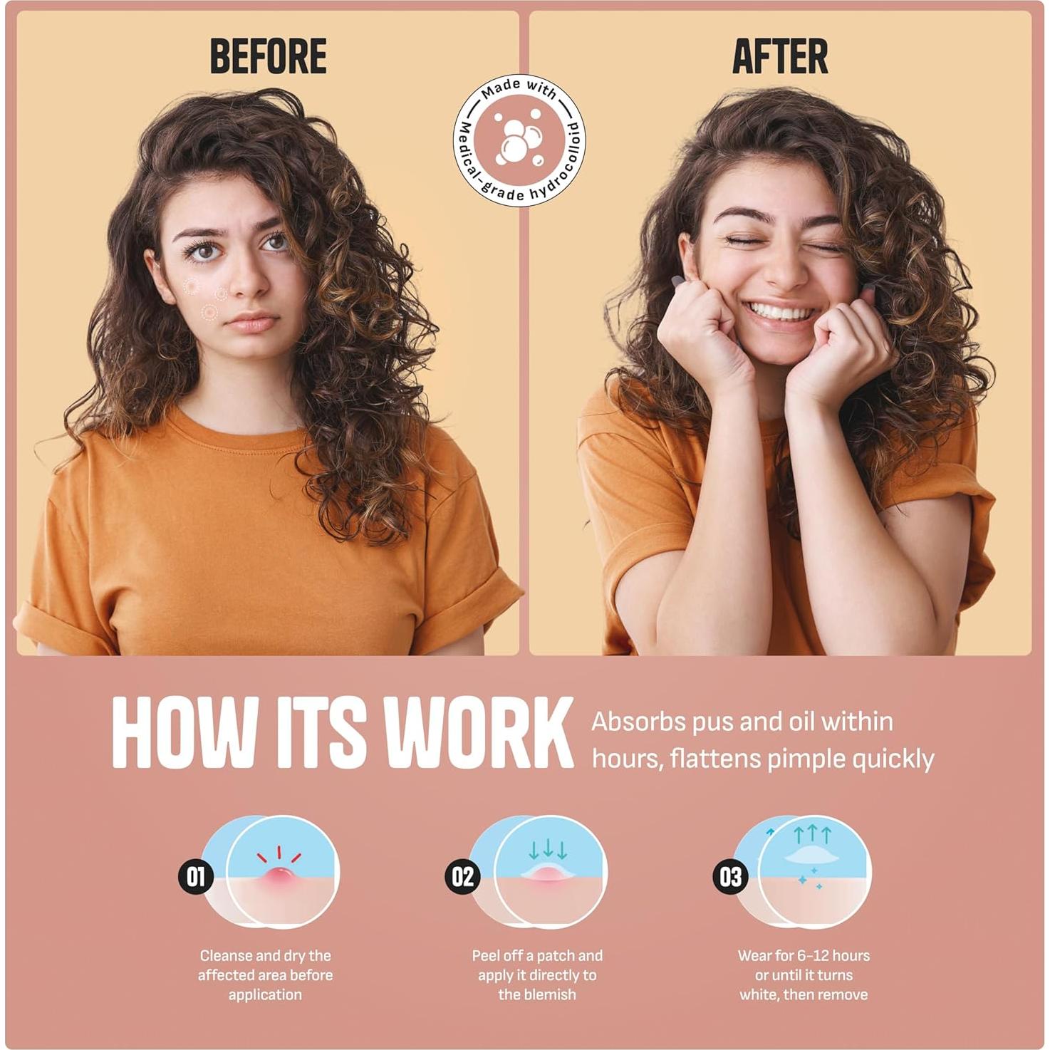 Parche Hidrocólico para Granos GoGleefy - 60 Unidades