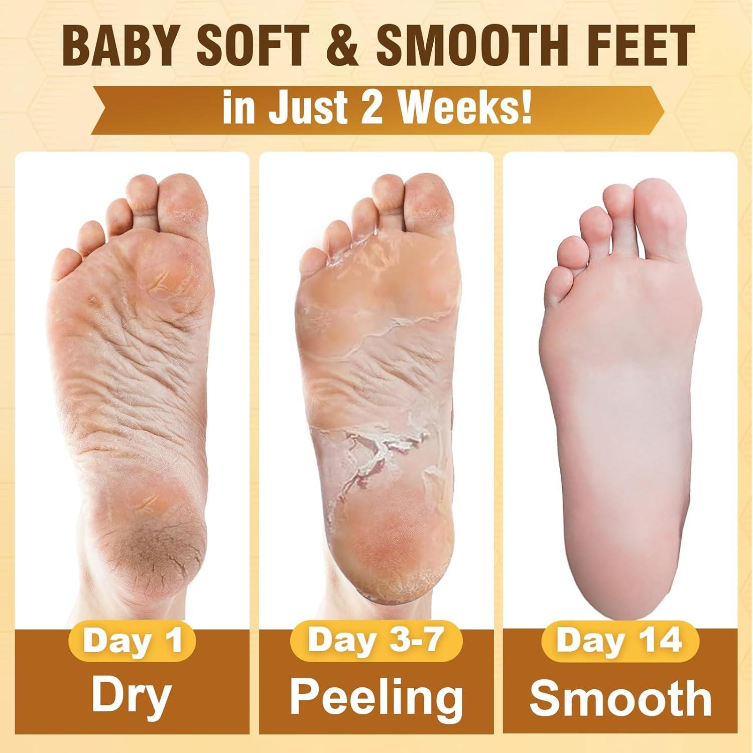 Juego de Mascarillas para Pies TEAWOO 6 Paquetes Exfoliantes e Hidratantes