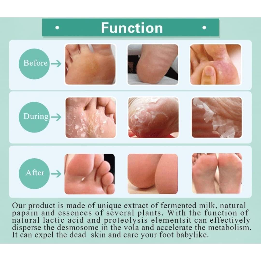 Mascarilla Exfoliante para Pies HODAF - 2 Paquetes, Suaves y Rejuvenecidos