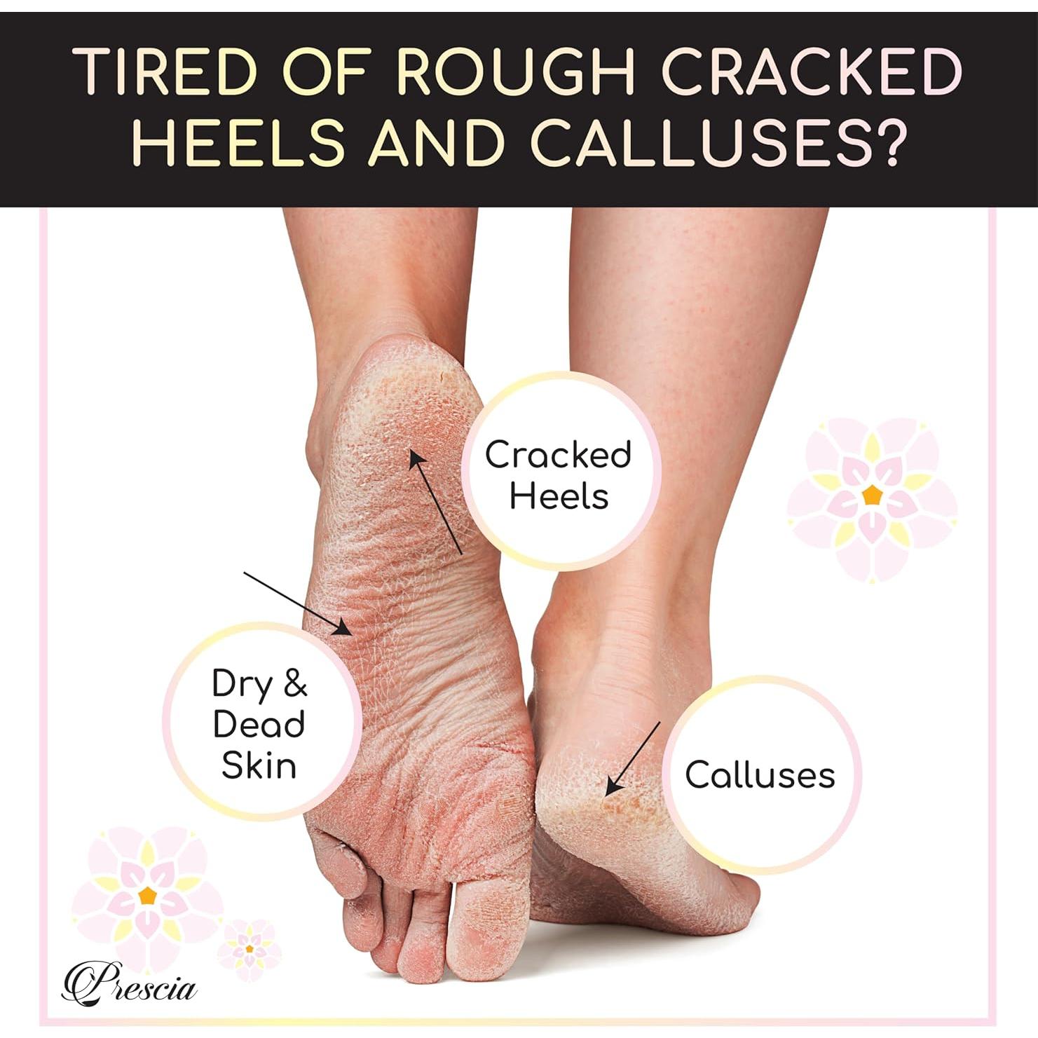 Mascarilla Exfoliante para Pies Crescena - Suaviza Talones Agrietados