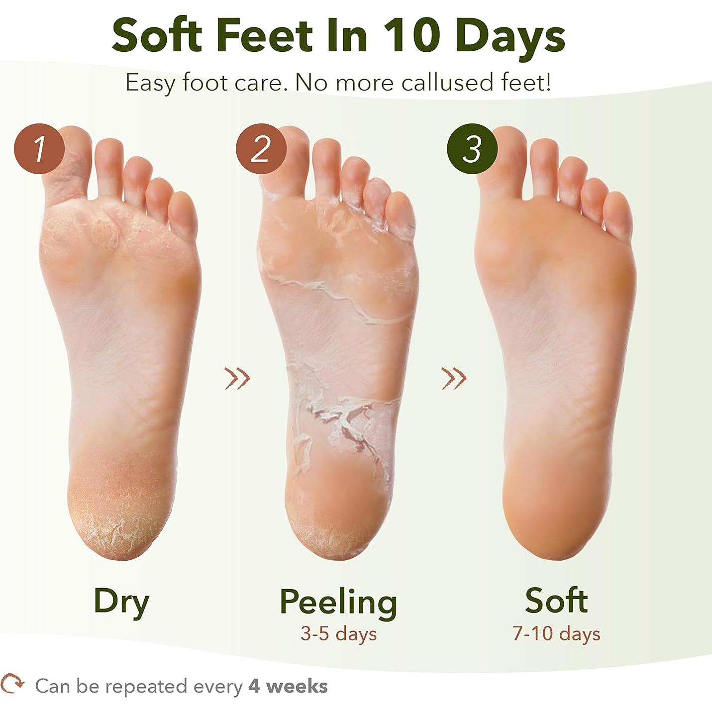 Mascarilla Exfoliante para Pies Purederm - 9 Unidades