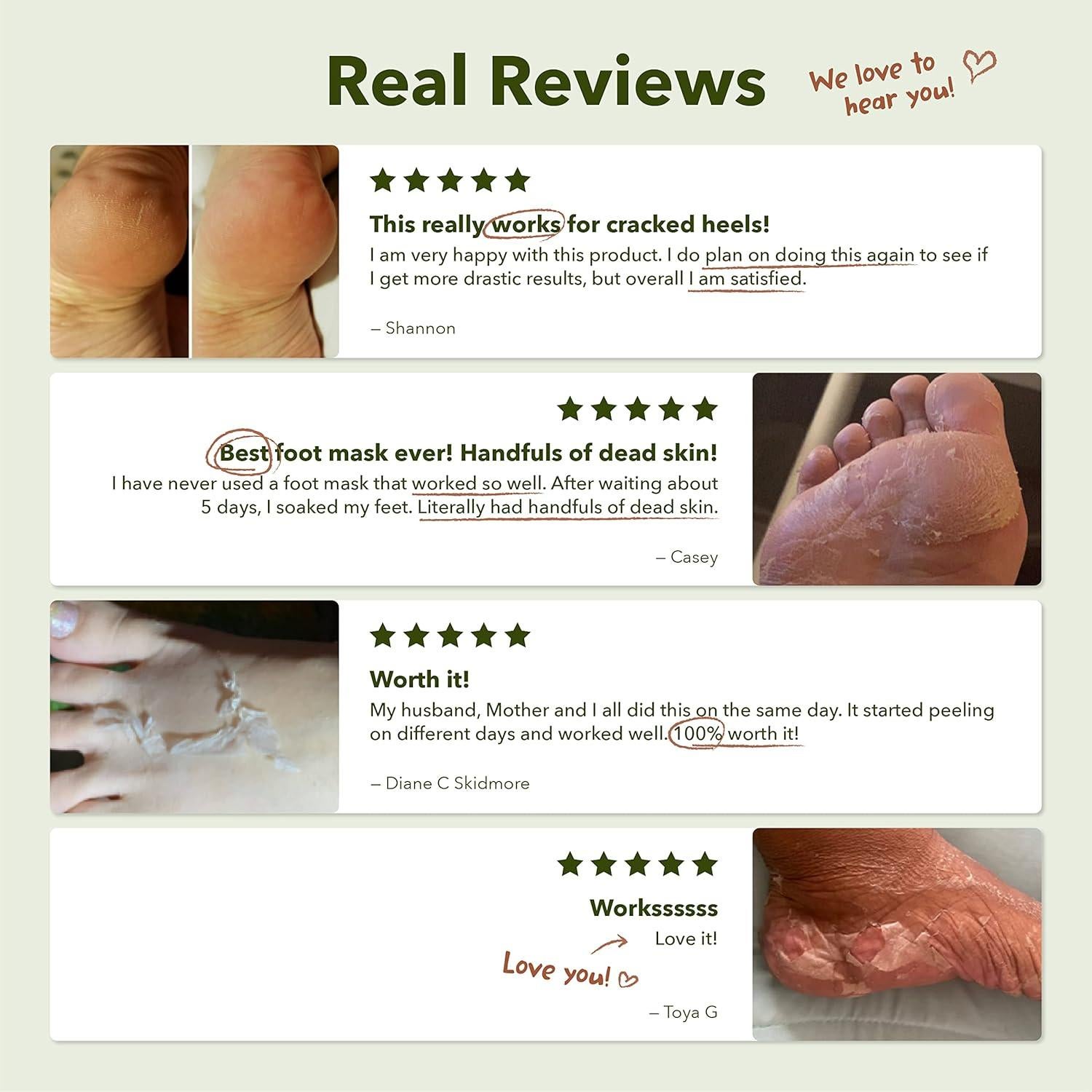 Mascarilla Exfoliante para Pies Purederm - 9 Unidades