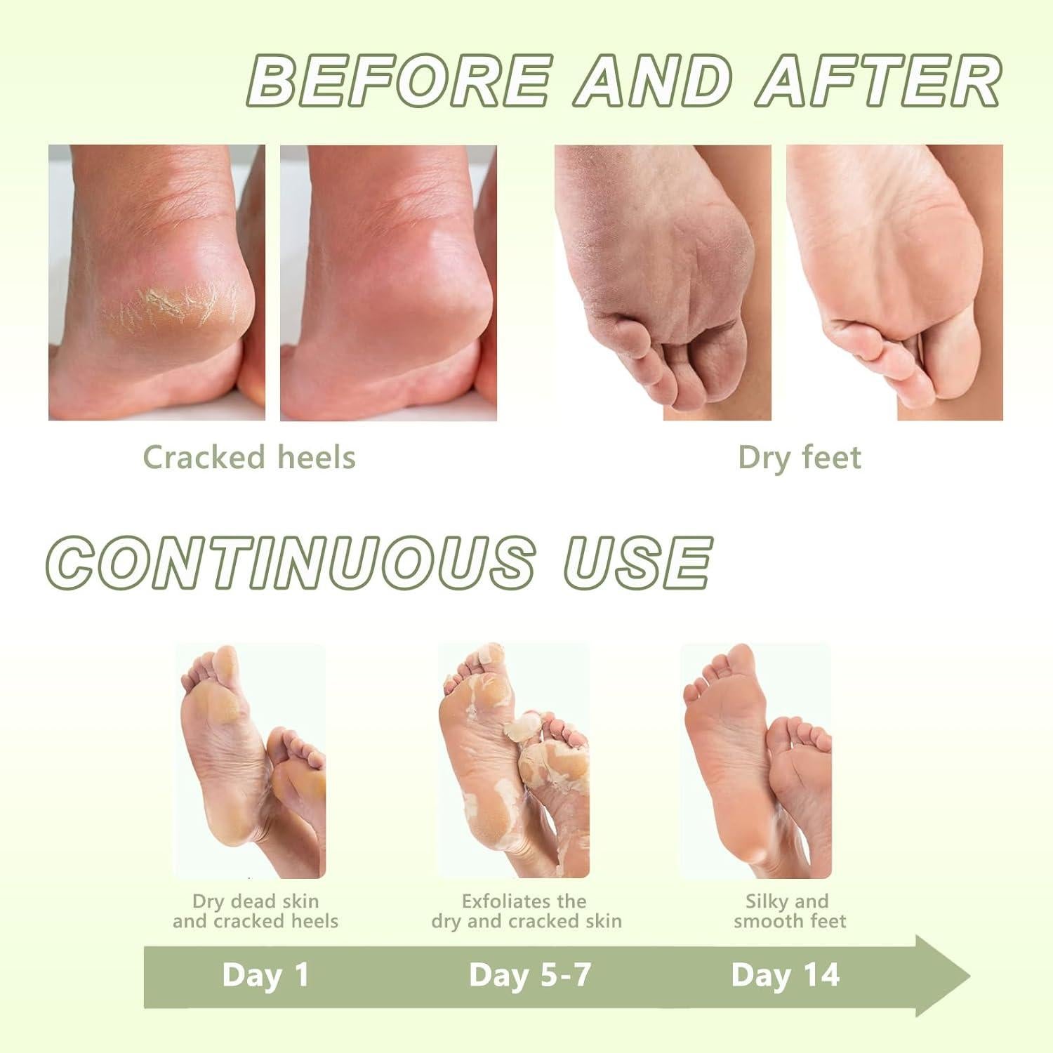 Mascarilla Exfoliante para Pies NAIAOHCR - 3 Pares Hidratantes