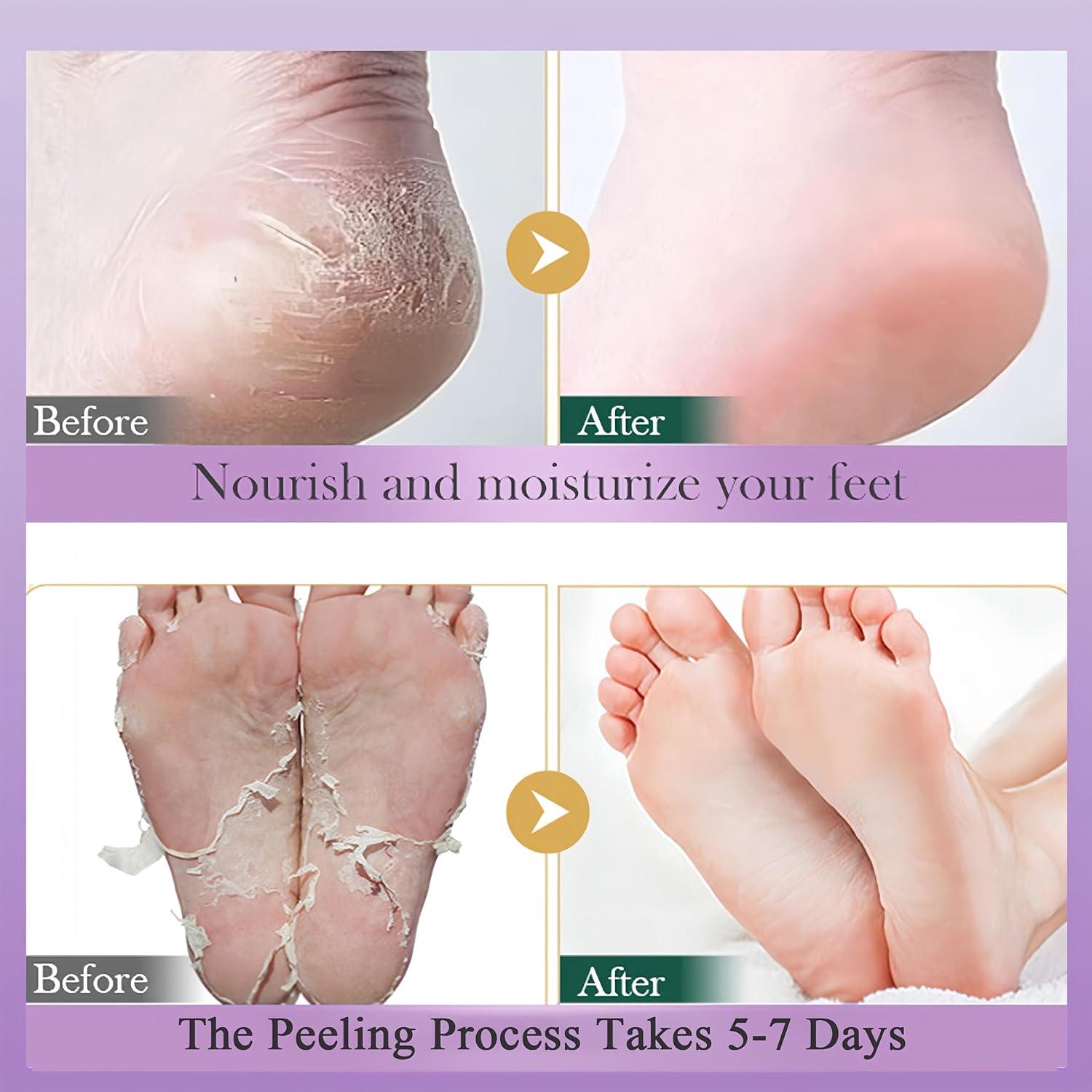 Mascarilla Exfoliante para Pies de Lavanda 5 Pares Hidratantes