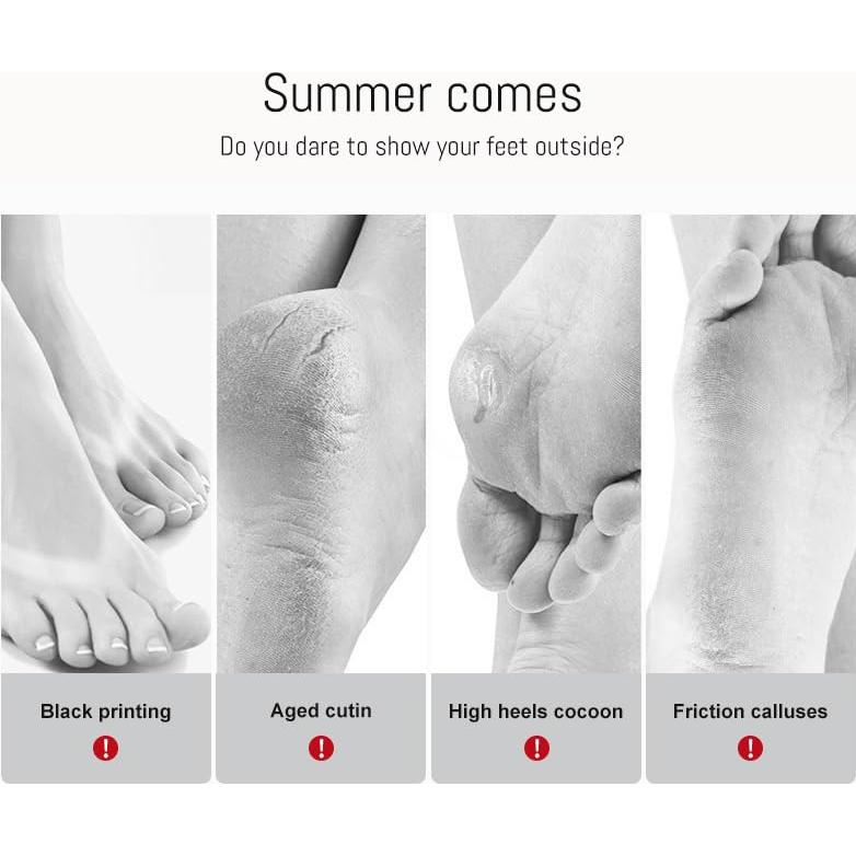 5 Pares Máscara Exfoliante para Pies AppXynn Aguacate y Karité