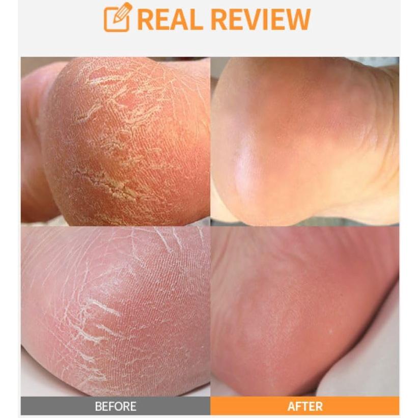 Stick Exfoliante para Pies SUNGBOON LHA - Peeling Suave y Hidratante