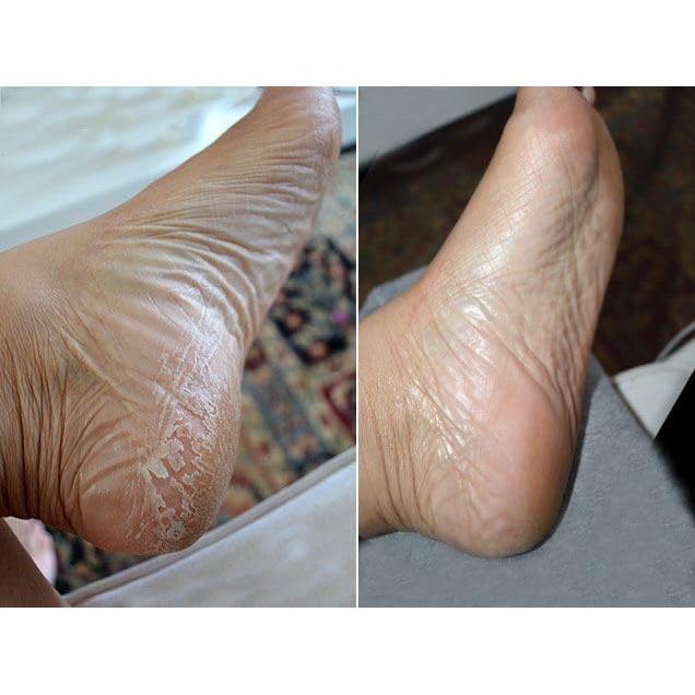 Paquete Spa para Pies Baby Foot - Exfoliante y Sal de Baño