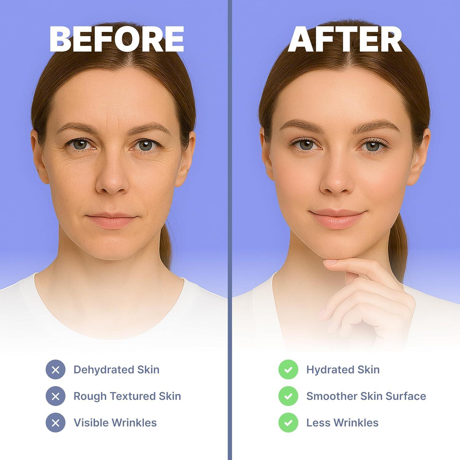 Parches Antiarrugas Bayside para Patas de Gallo y Frente - 60 Unidades