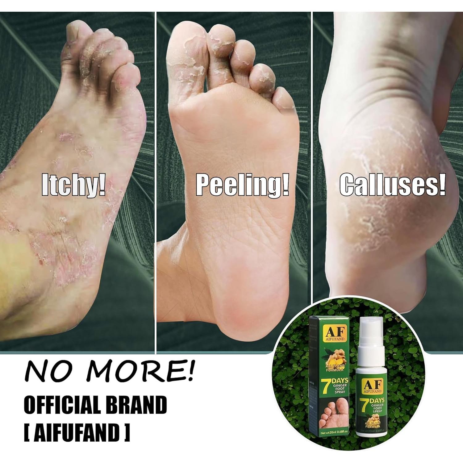 Spray para Pies HolistiCare 20 ml - Sin Fragancia, Jengibre