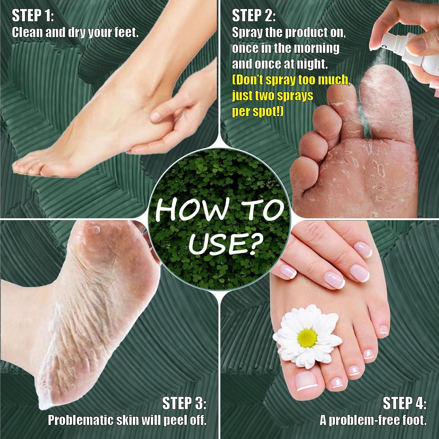 Spray para Pies HolistiCare 20 ml - Sin Fragancia, Jengibre