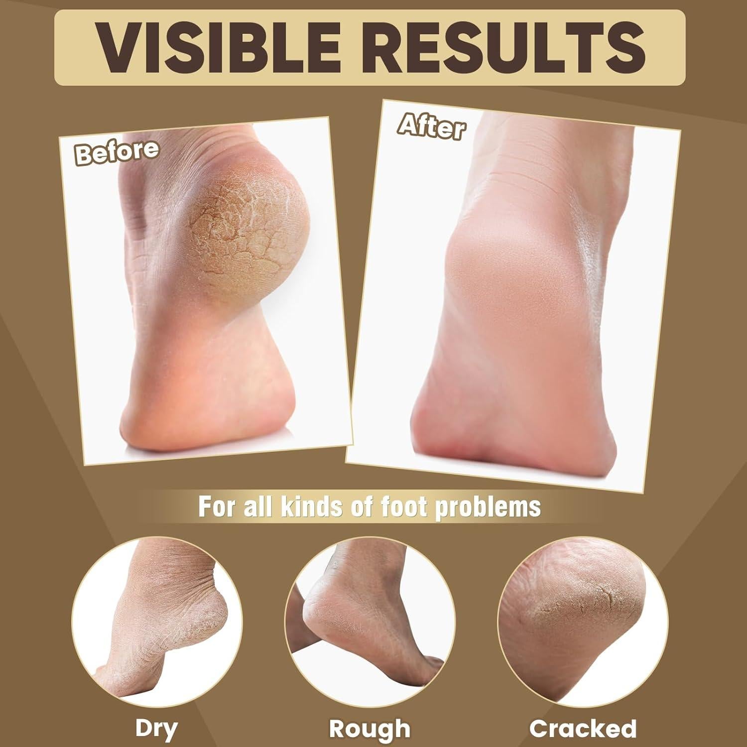 18 Mascarillas Hidratantes para Pies TEAWOO con Aceite de Ricino