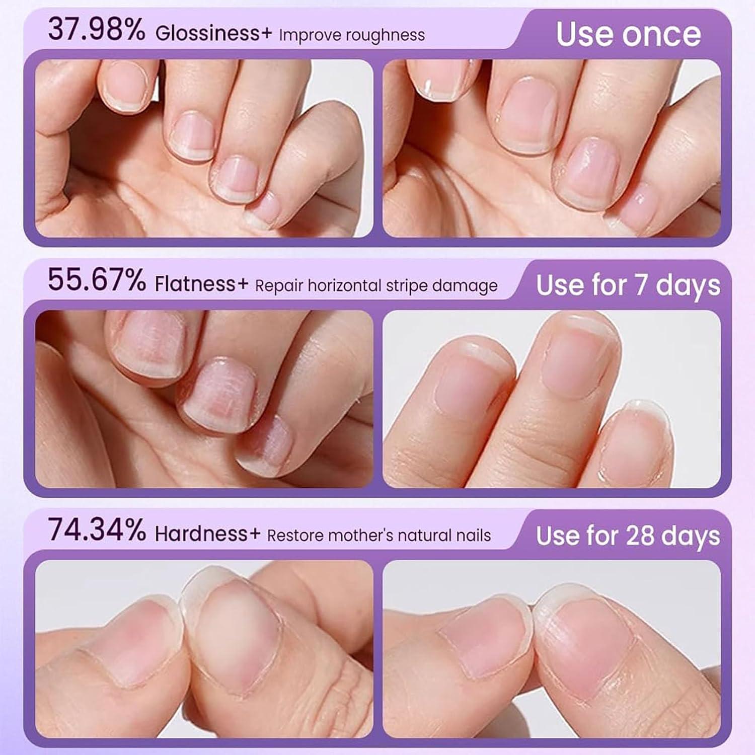 Bolígrafo de Aceite para Cutículas 3-en-1 Genérico Morado